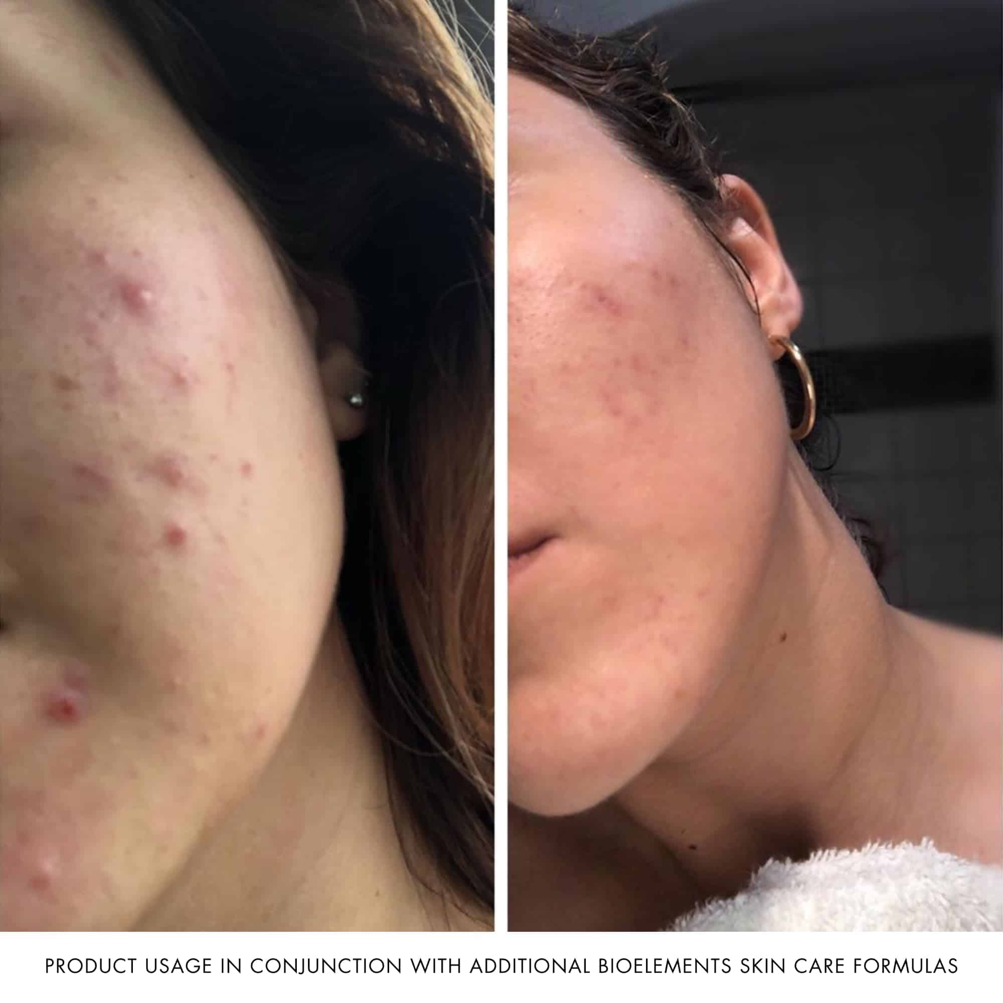 Bioelements Crucial Moisture - 2.5 fl oz - Crema Emoliente - Imagen 6