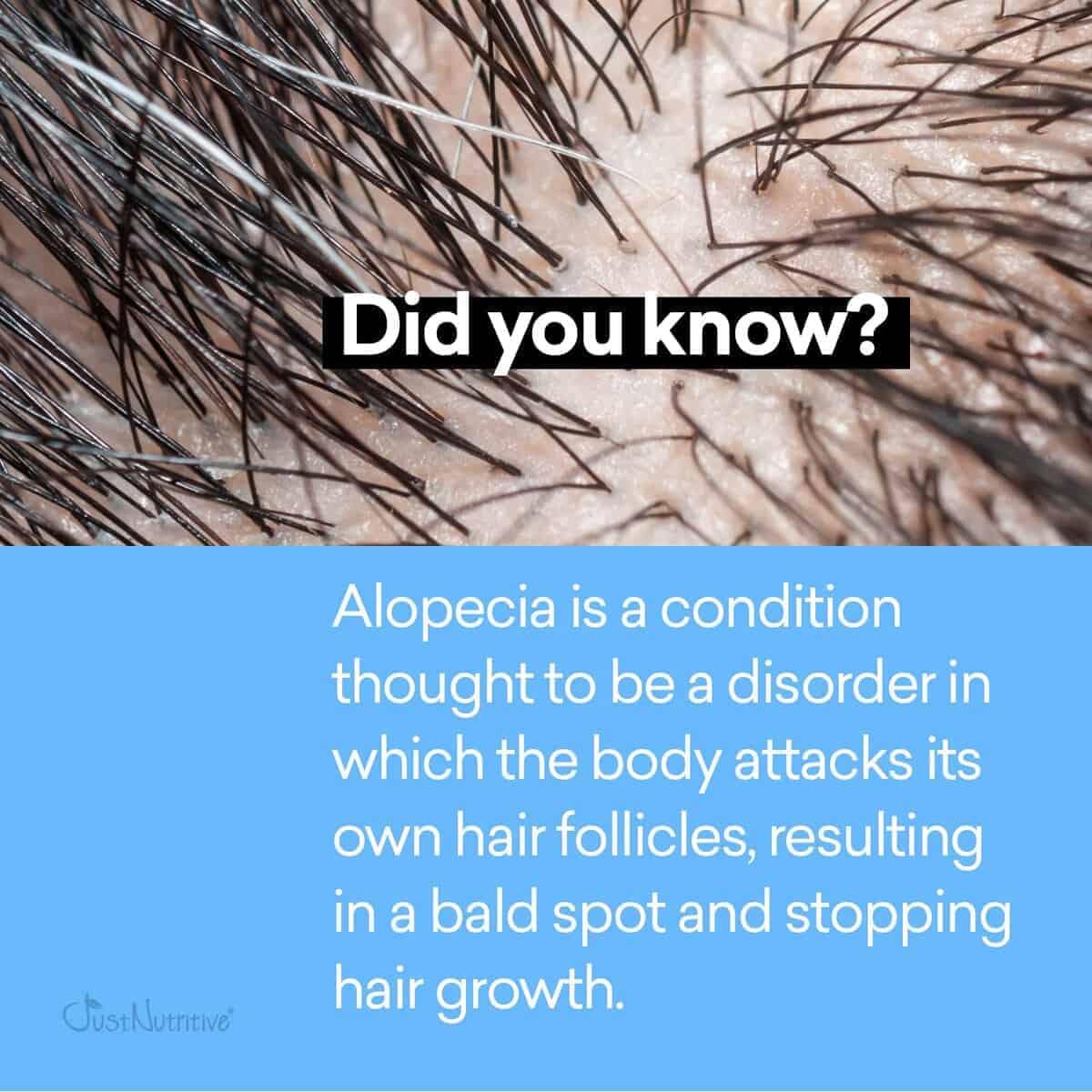 Tratamiento para la pérdida del cabello Alopecia Renewal | - Imagen 3