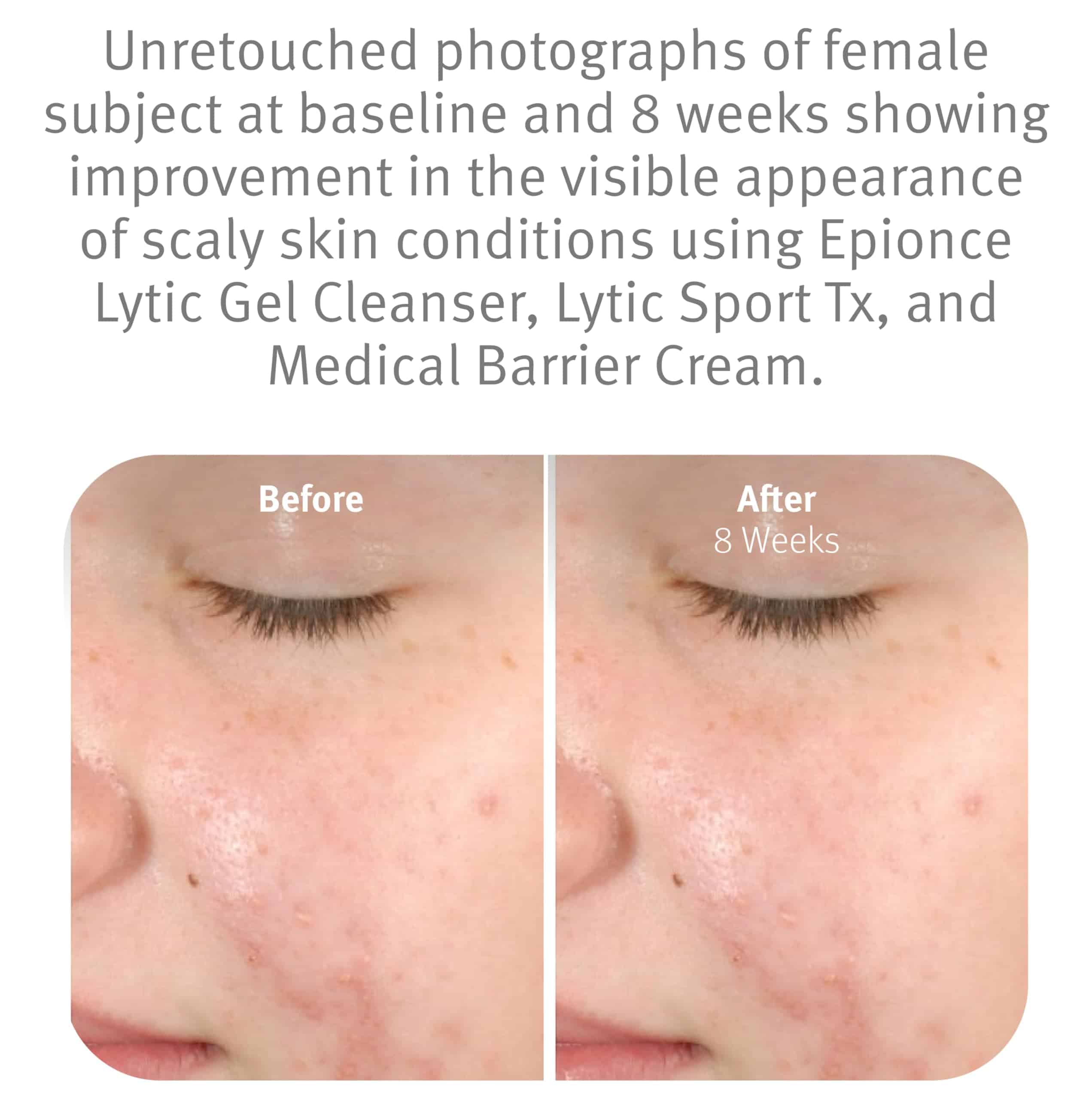 Limpiador de Gel Epionce - Limpiador Facial y - Imagen 5