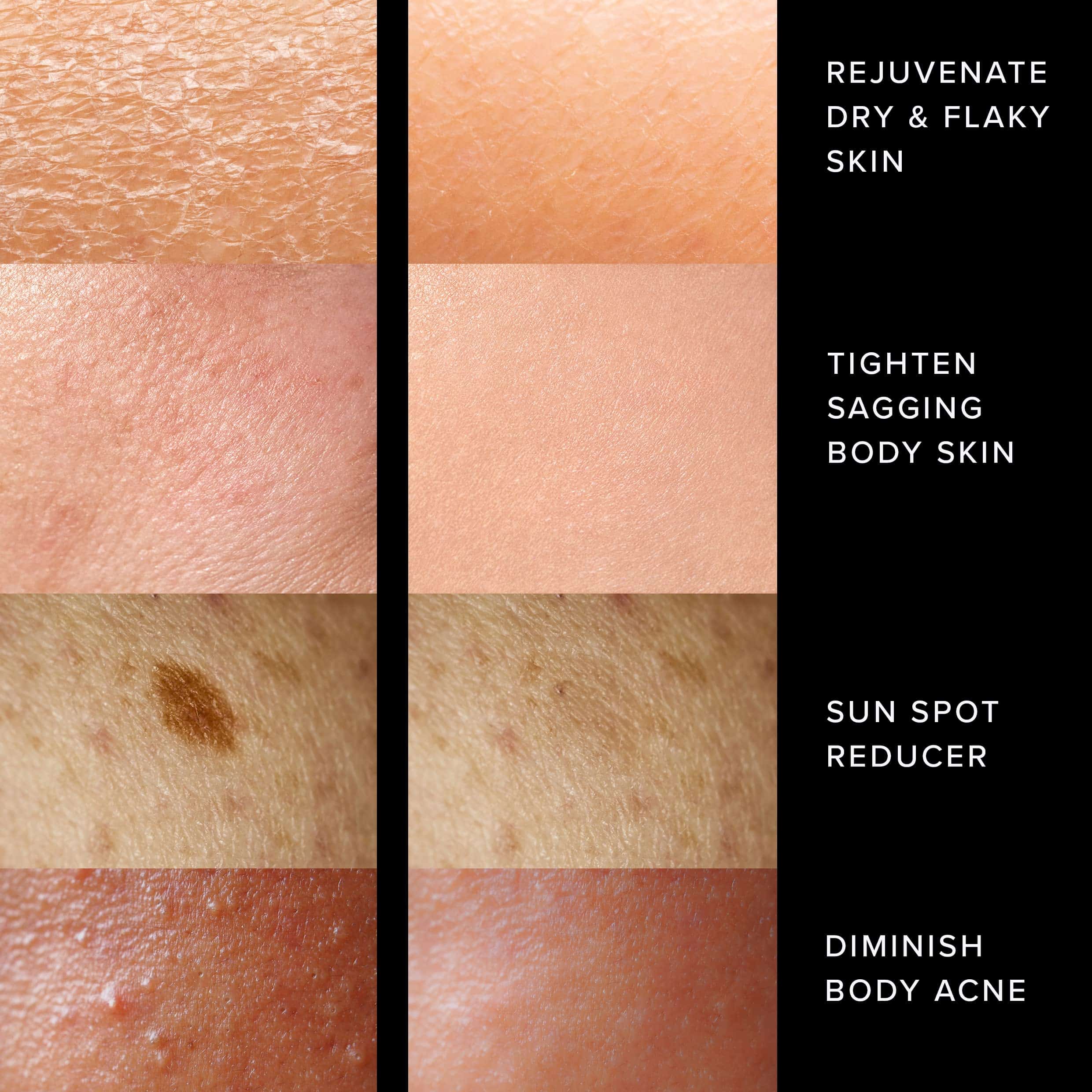 Adonia StemuTone - Loción Corporal Reafirmante a base de - Imagen 6