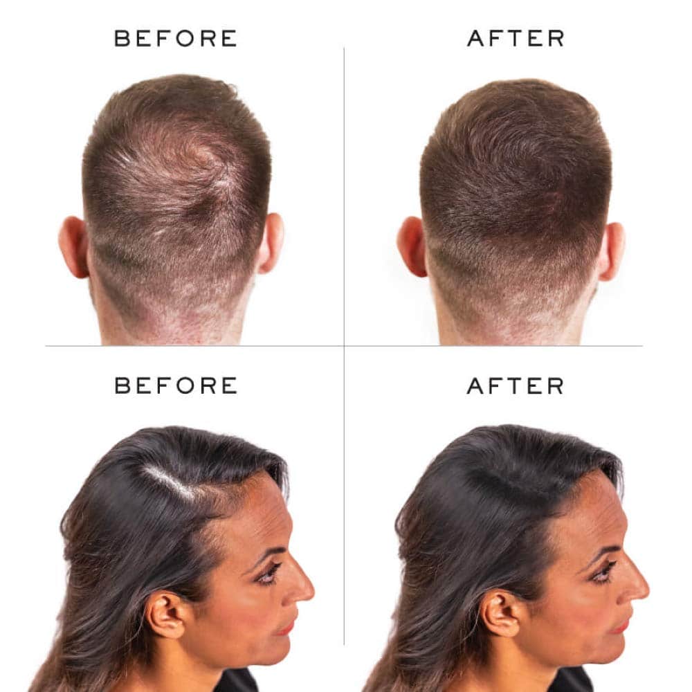 Fibras Capilares de Queratina Nanogen, 30 gramos, Castaño - Imagen 5