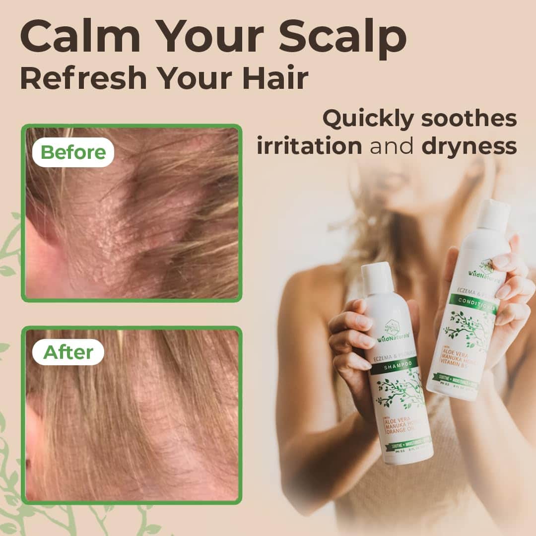 Set de Shampoo y Acondicionador para Eczema y Psoriasis - - Imagen 7