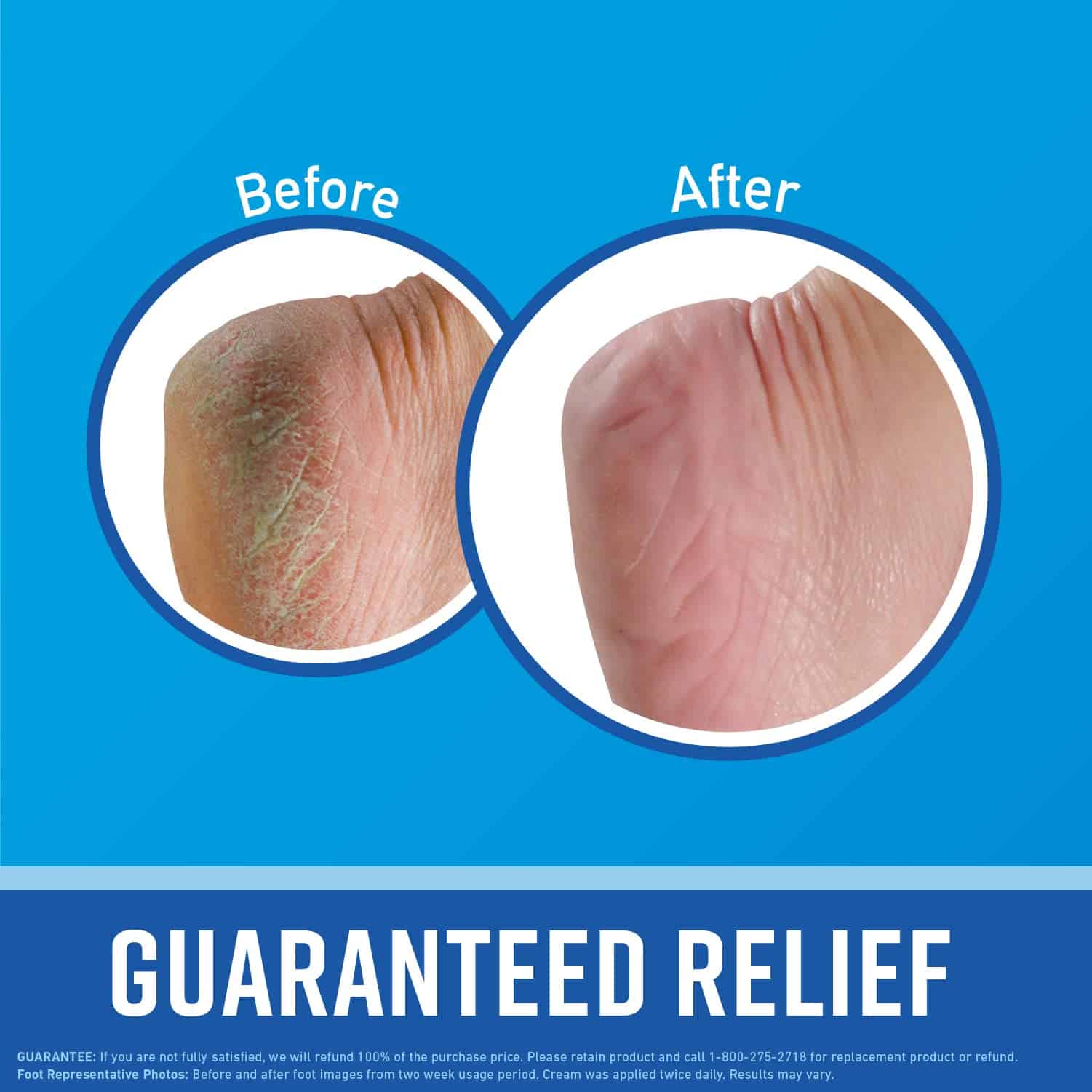 Crema para Pies O'Keeffe's para Pies Saludables; Alivio - Imagen 3