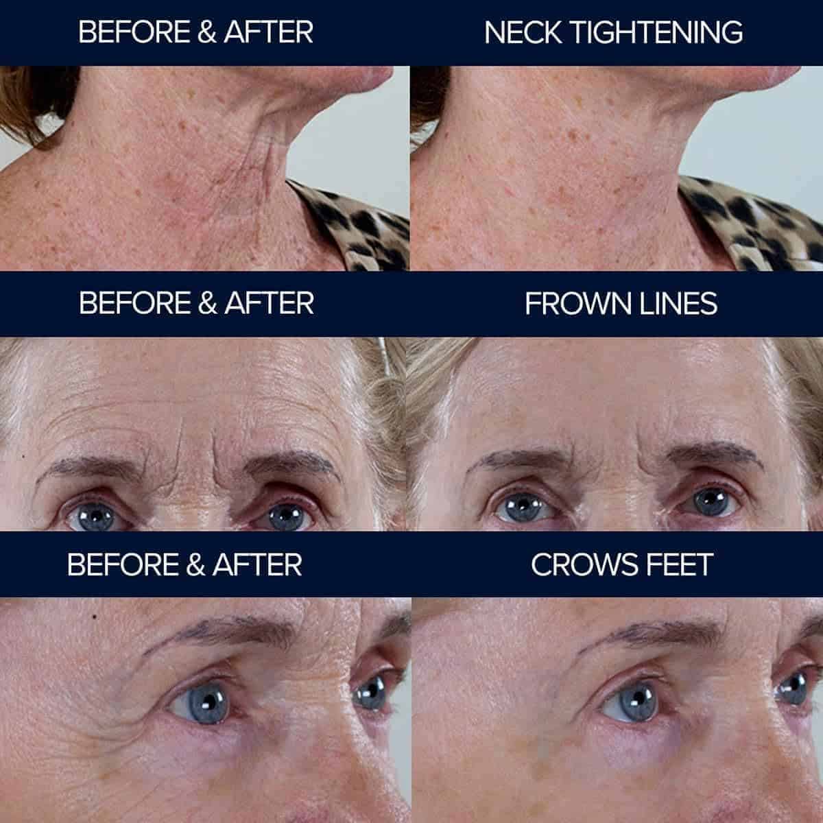 Suero de péptidos anti envejecimiento Adonia Organics - Imagen 5