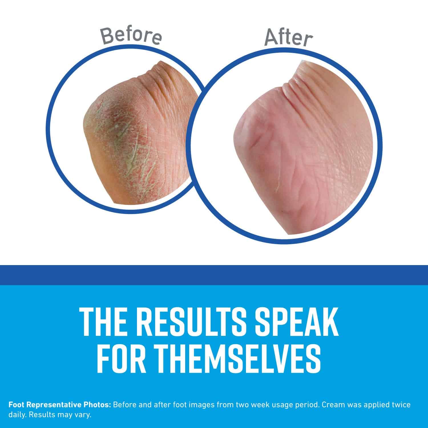 Crema para pies O'Keeffe's K0320001-5 Healthy Feet en - Imagen 4