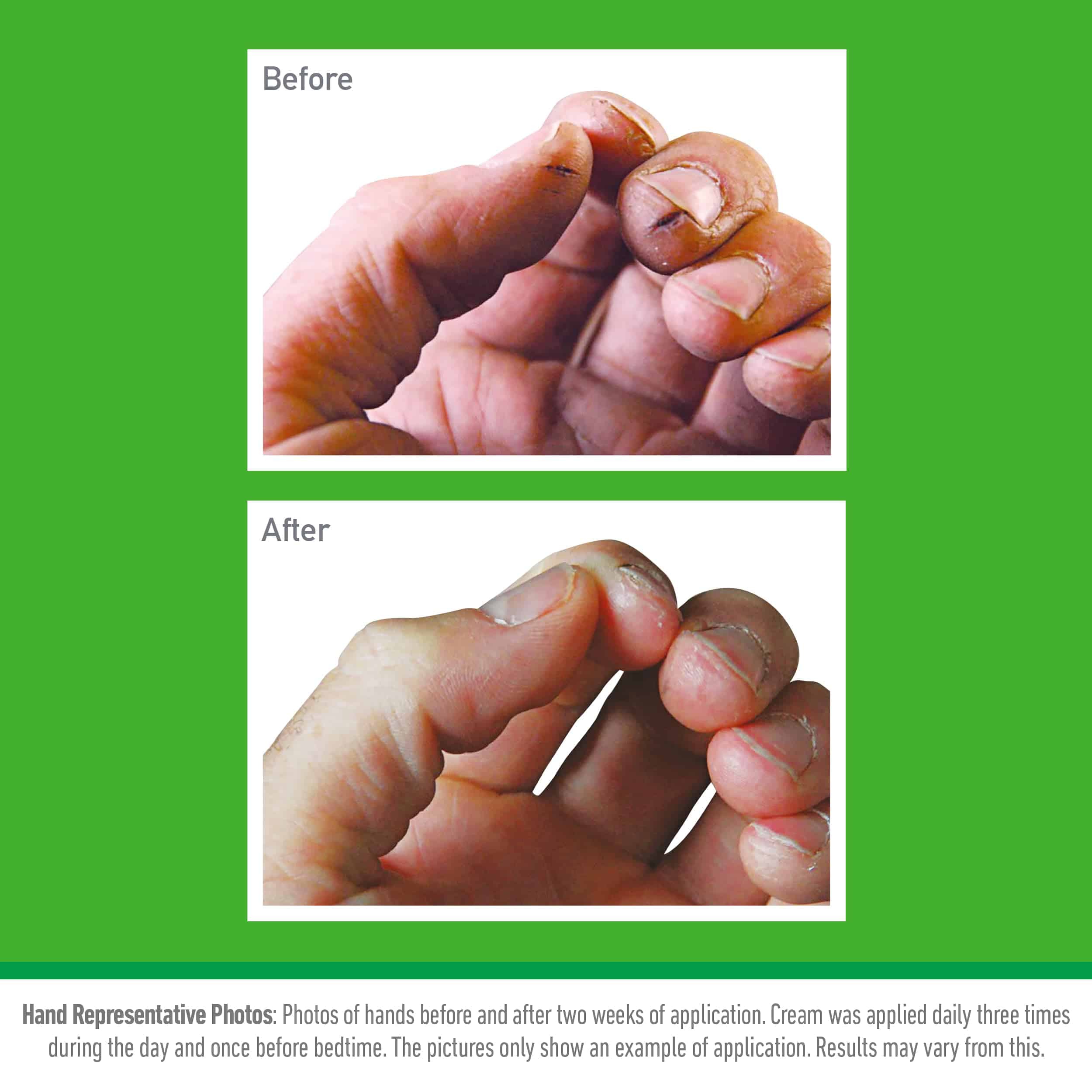 Crema de manos O'Keeffe's K0350002-6 Working Hands en - Imagen 5