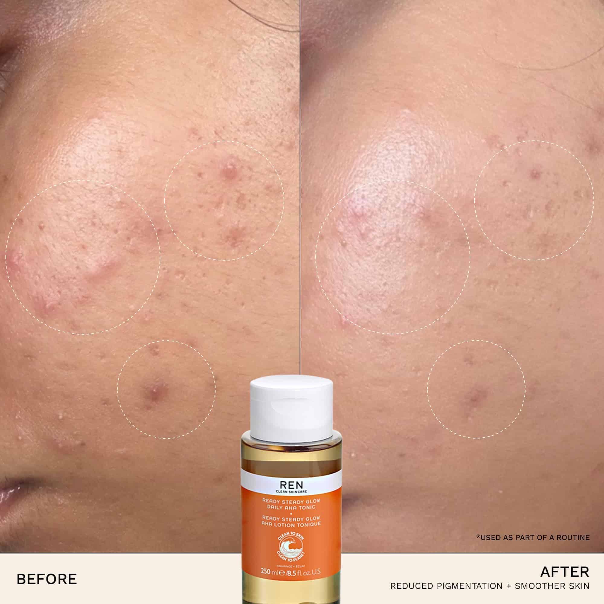 REN Clean Skincare Glow Tonic - Tónico Facial Diario - Imagen 3