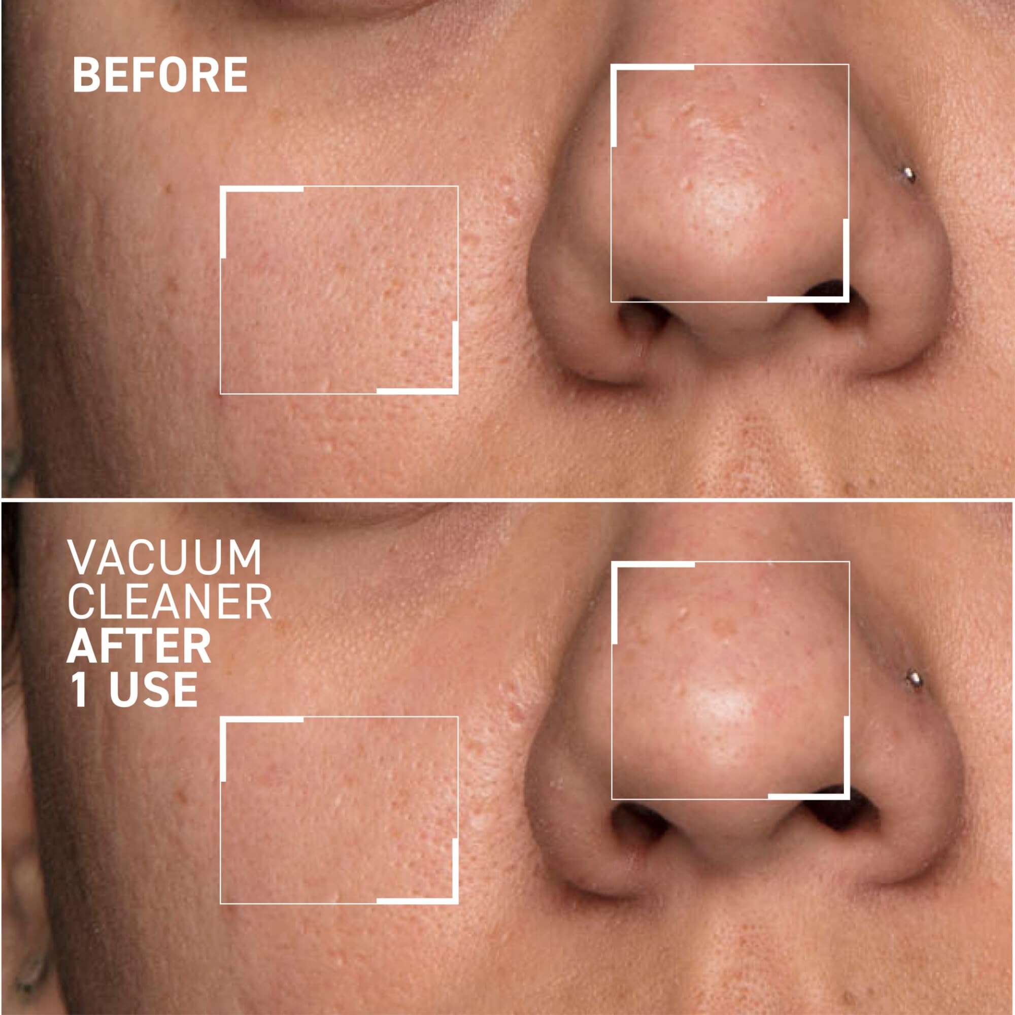 Dr. Brandt Pores No More Vacuum Cleaner - Mascarilla - Imagen 5