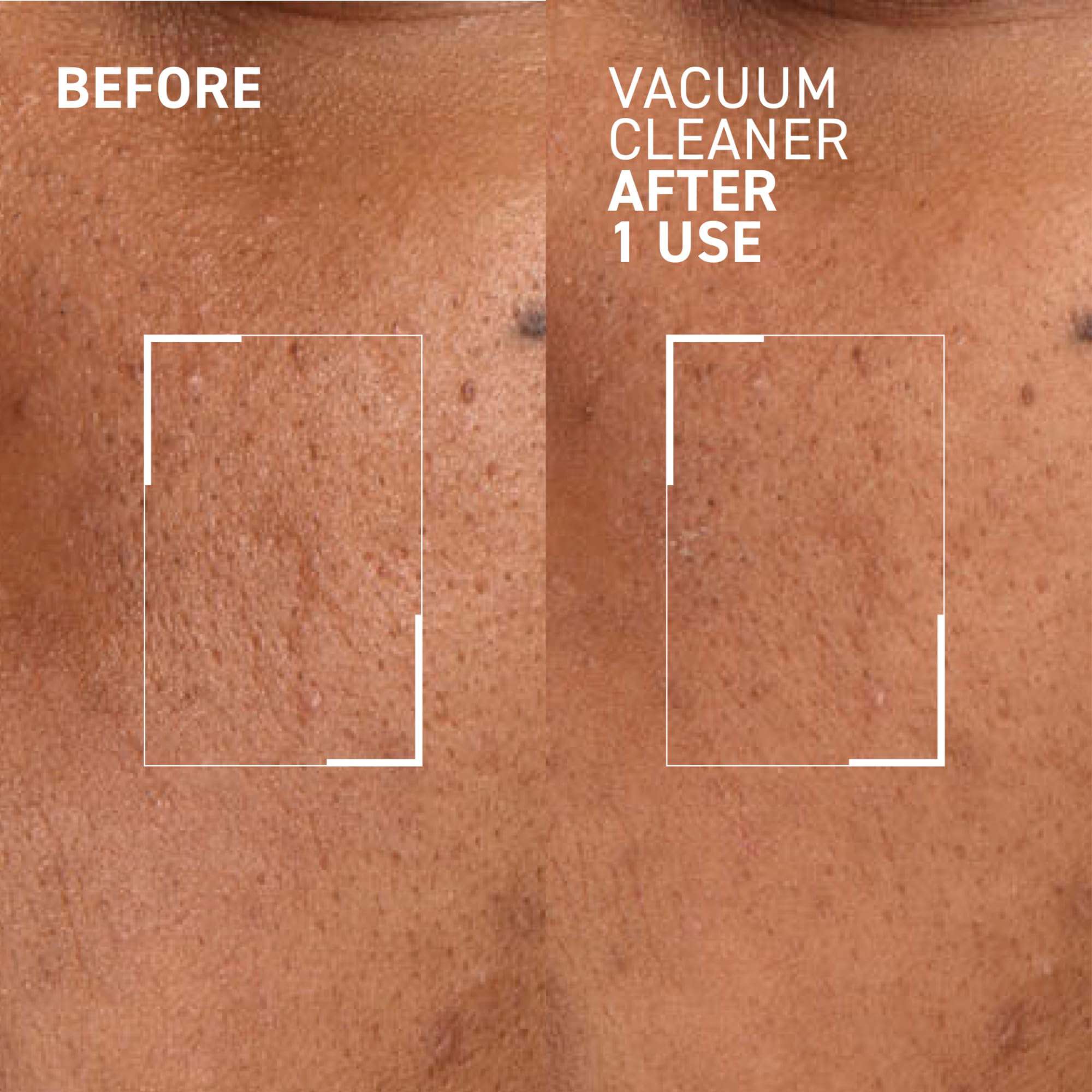 Dr. Brandt Pores No More Vacuum Cleaner - Mascarilla - Imagen 4