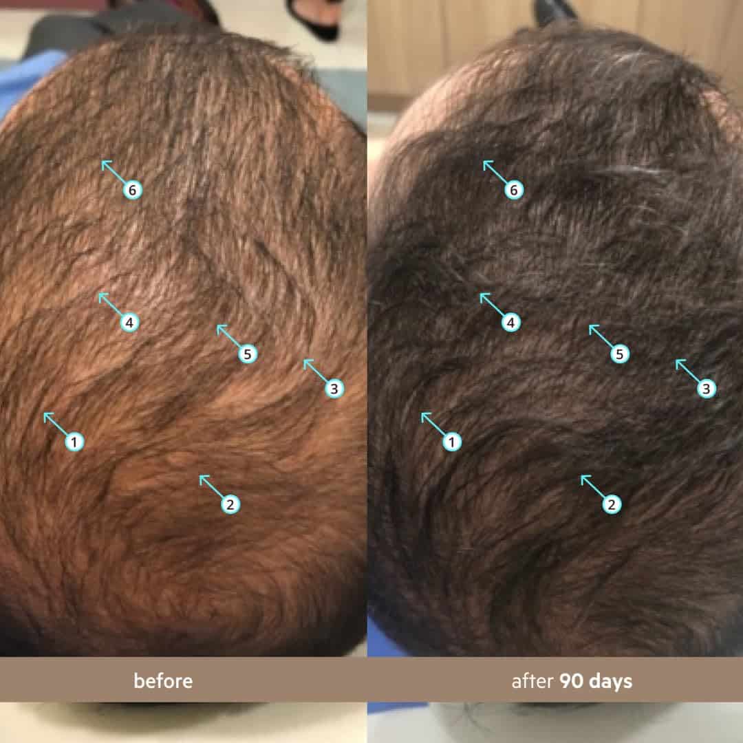 DS Labs Spectral Men's Formally Spectral.DNC-N - Suero para - Imagen 5