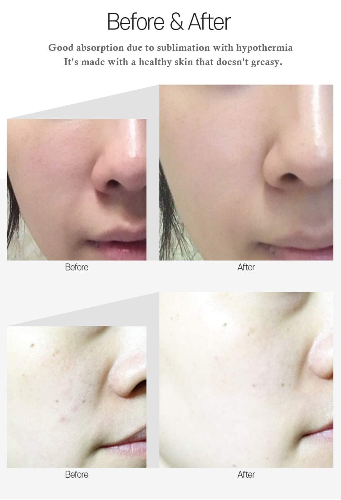 Ampolla Medi-Peel 5Growth Factor Bor-Tox Peptide 30ml, - Imagen 7