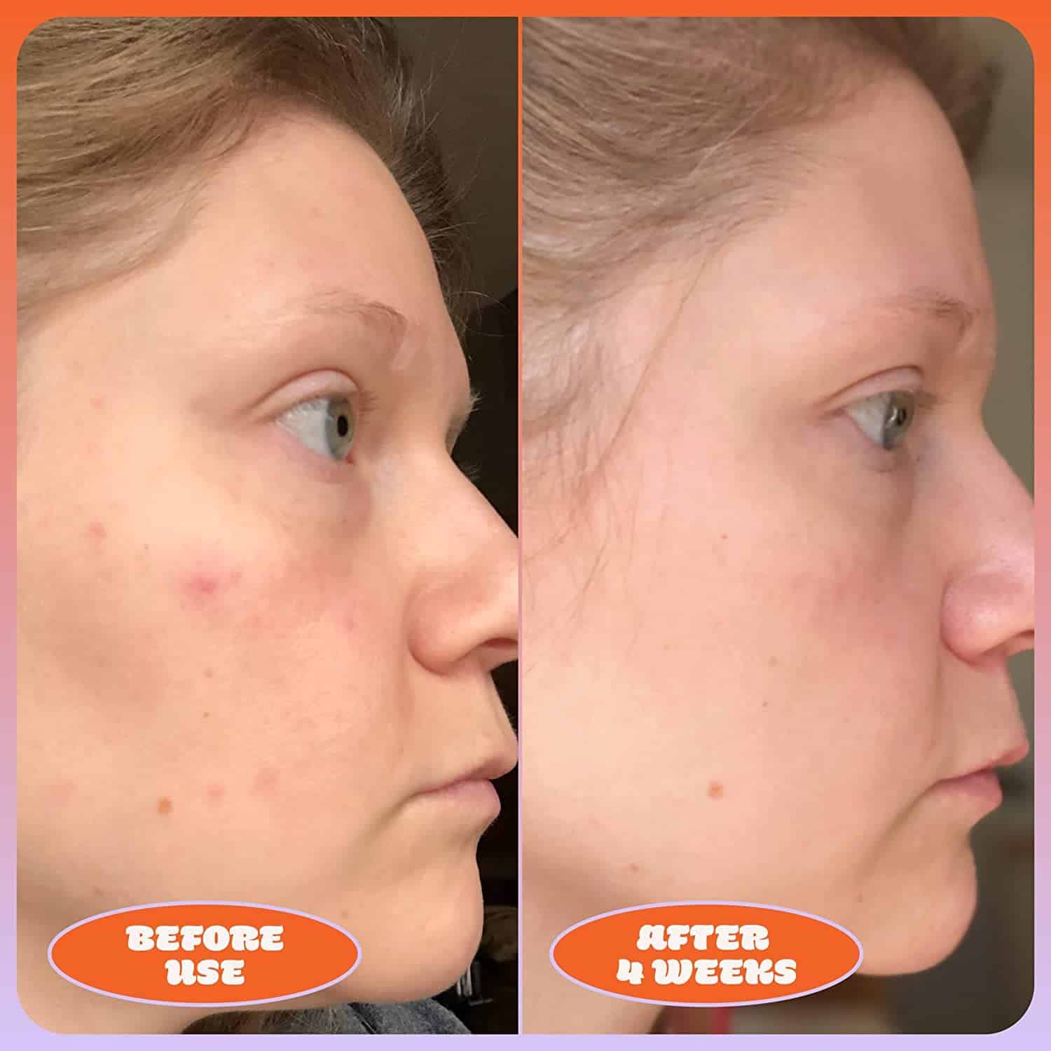 Suero Blume Milky Fade Spot & Scar Fade - Suero para - Imagen 6