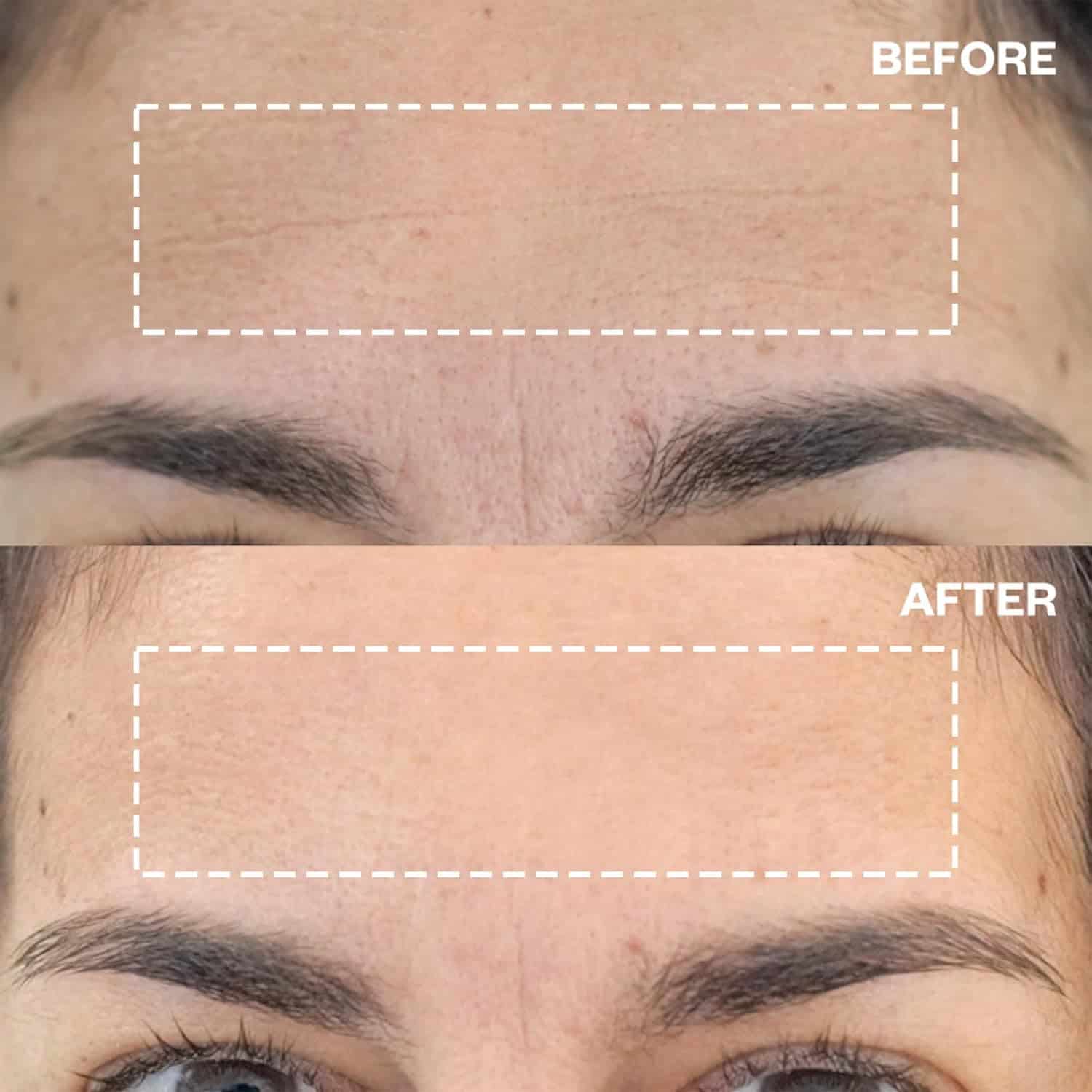 Parches de silicona hipoalergénica reutilizable para las - Imagen 4