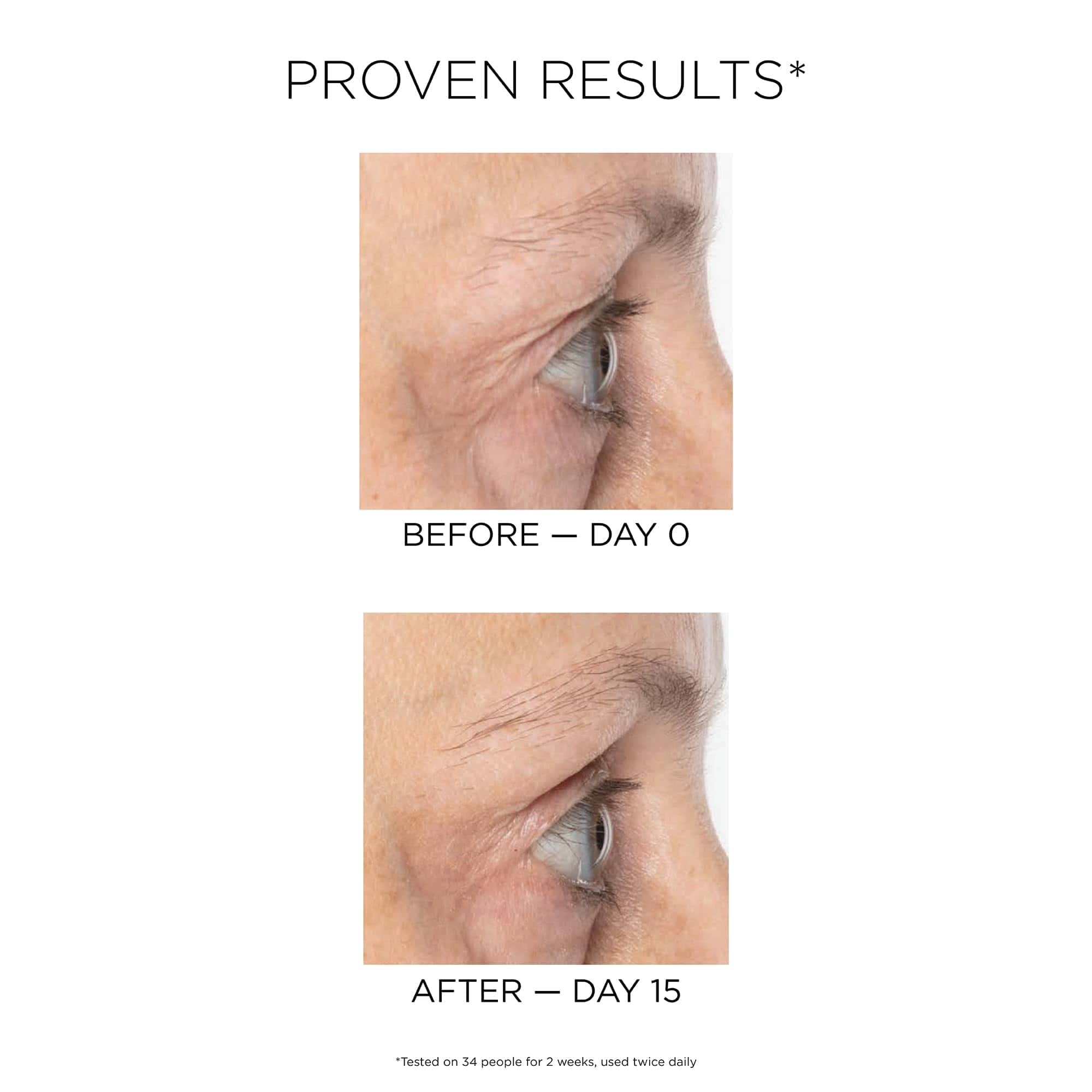 Serum Anti-Envejecimiento IDC Dermo Boost Collagen Pro - 1 - Imagen 5
