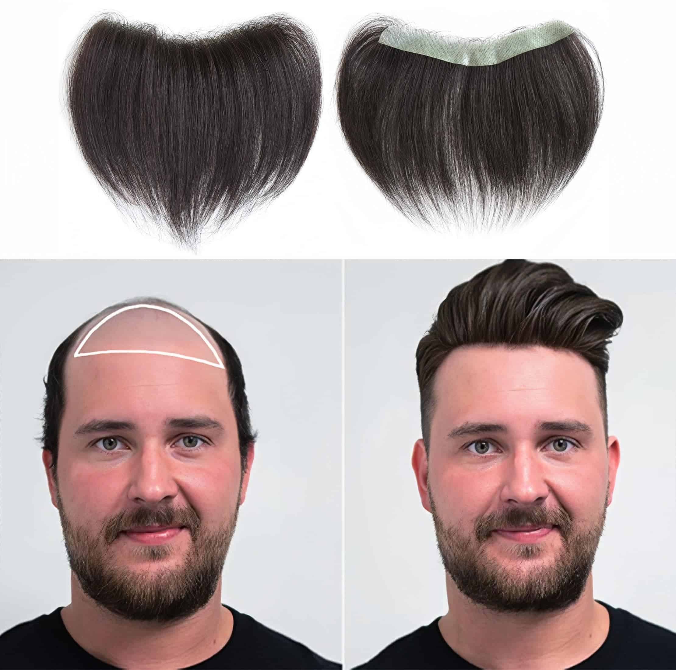 Meiverah Extensiones de Cabello Frontales para Hombres Pelo