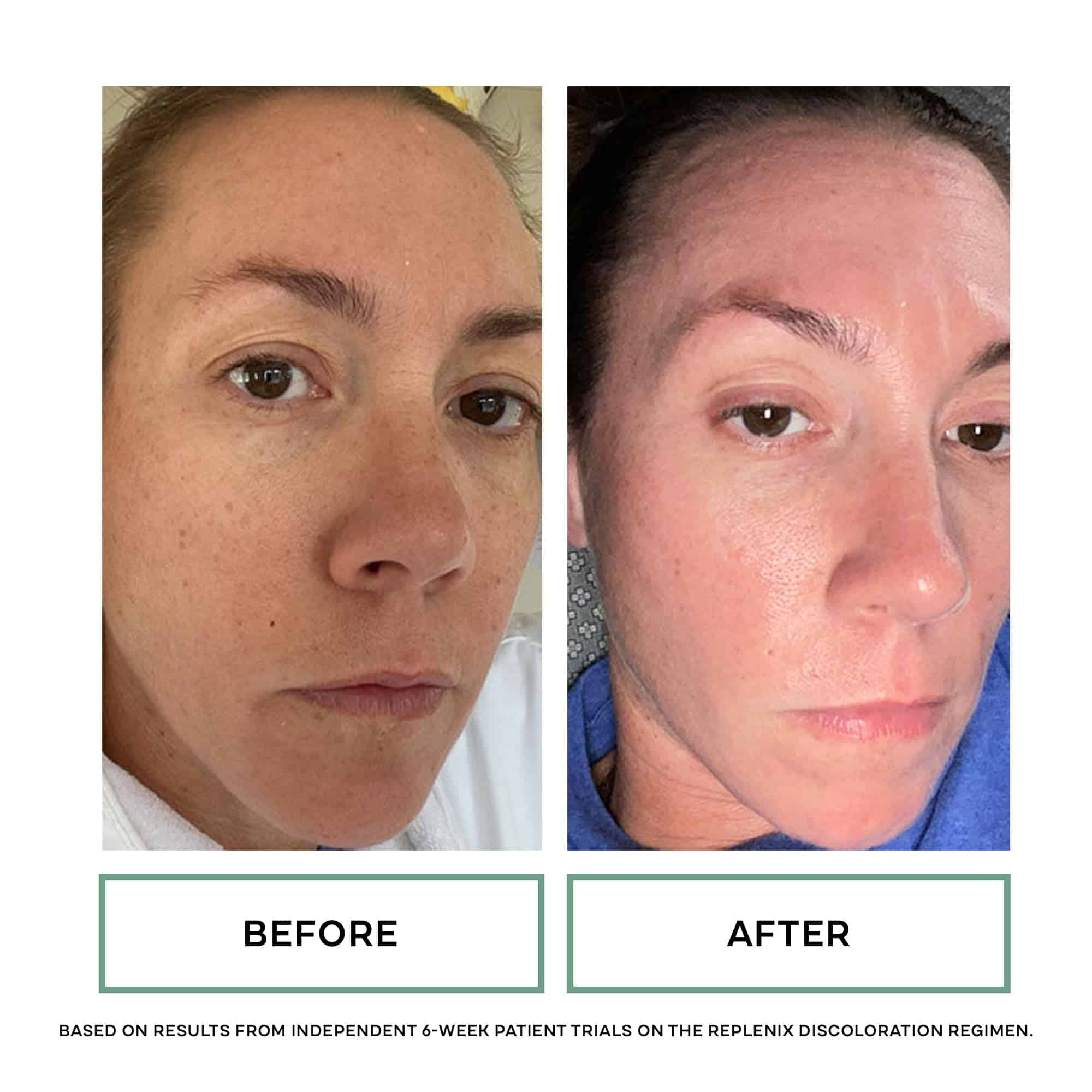 Crema Replenix Pigment Correcting Brightening, Hidratante - Imagen 6