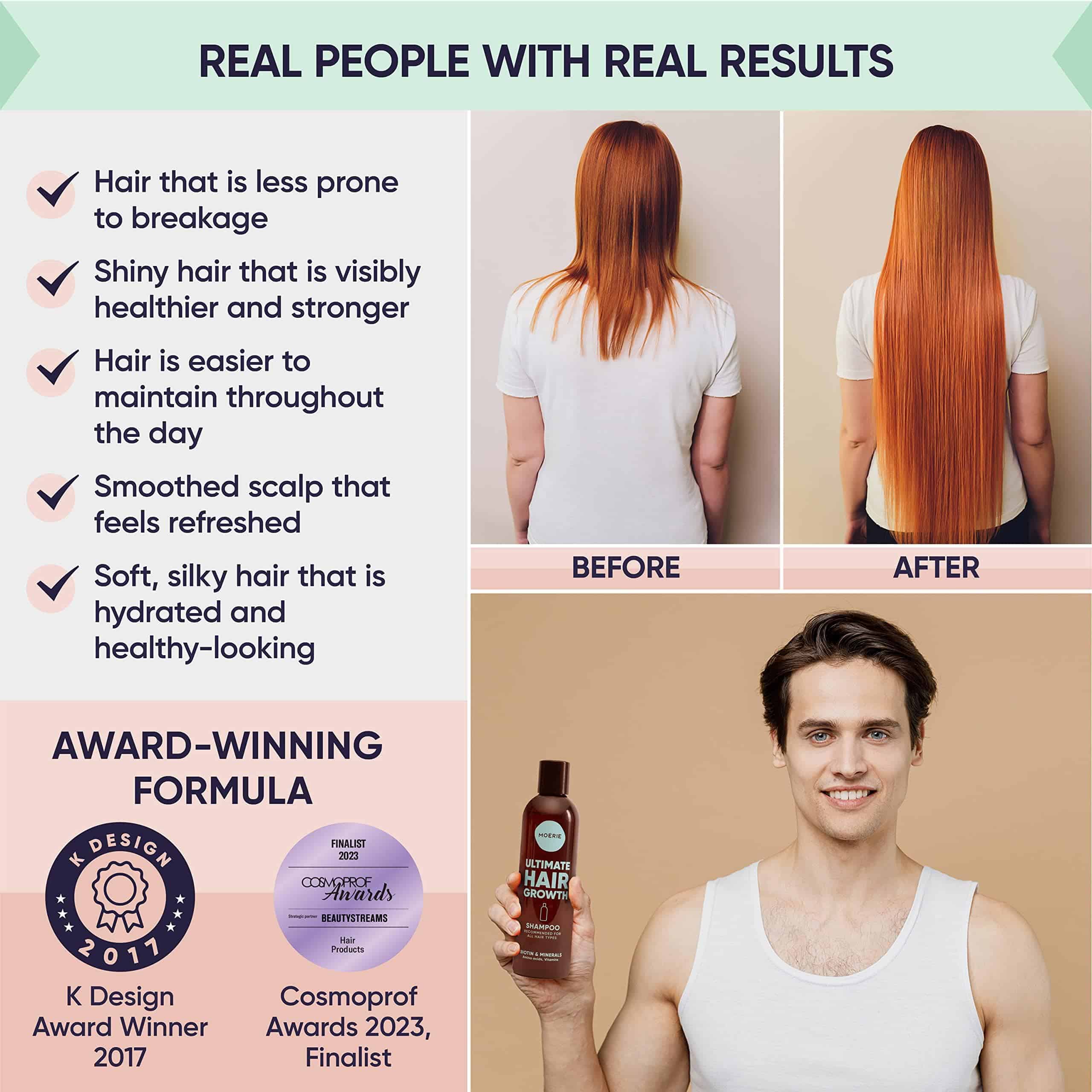 Acondicionador Moerie de Crecimiento Capilar Definitivo - - Imagen 4