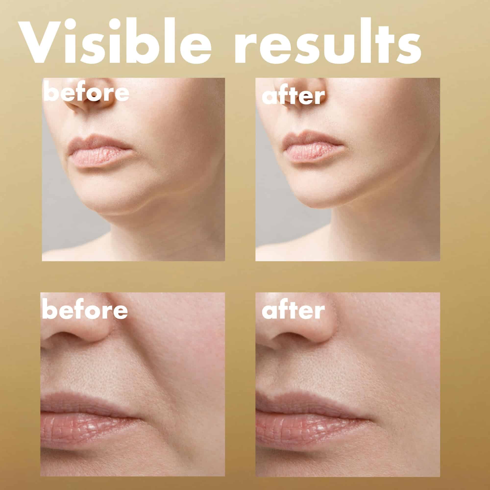 Suero ISOI Intensive Lifting, Suero Premium Hidratante para - Imagen 4