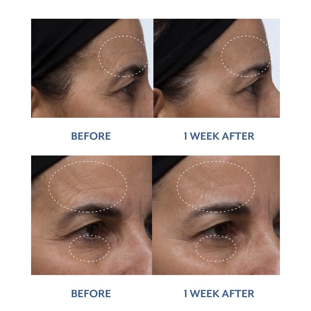 Bloomeffects - Exfoliante Natural de Pétalos de Tulipán - Imagen 8