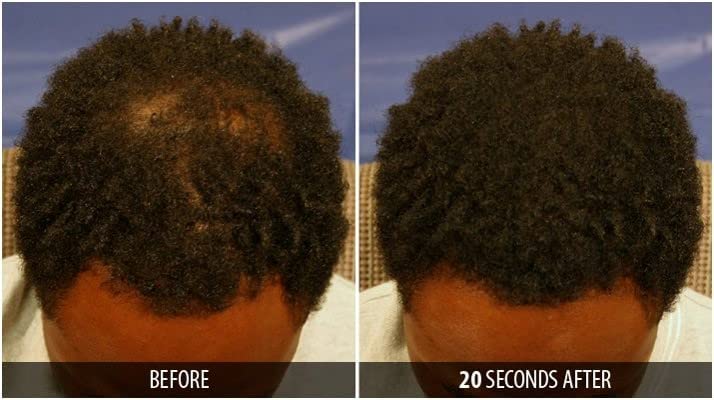 Dr. Yates MD Keratin Fiber Hair Enhancer (Auburn) - Imagen 5