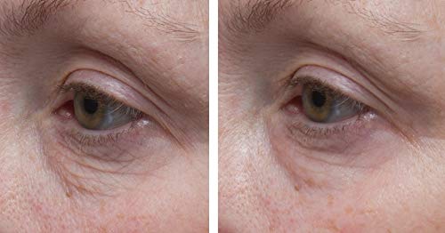 Crema Facial de Colágeno Dr. Denese SkinScience para - Imagen 3