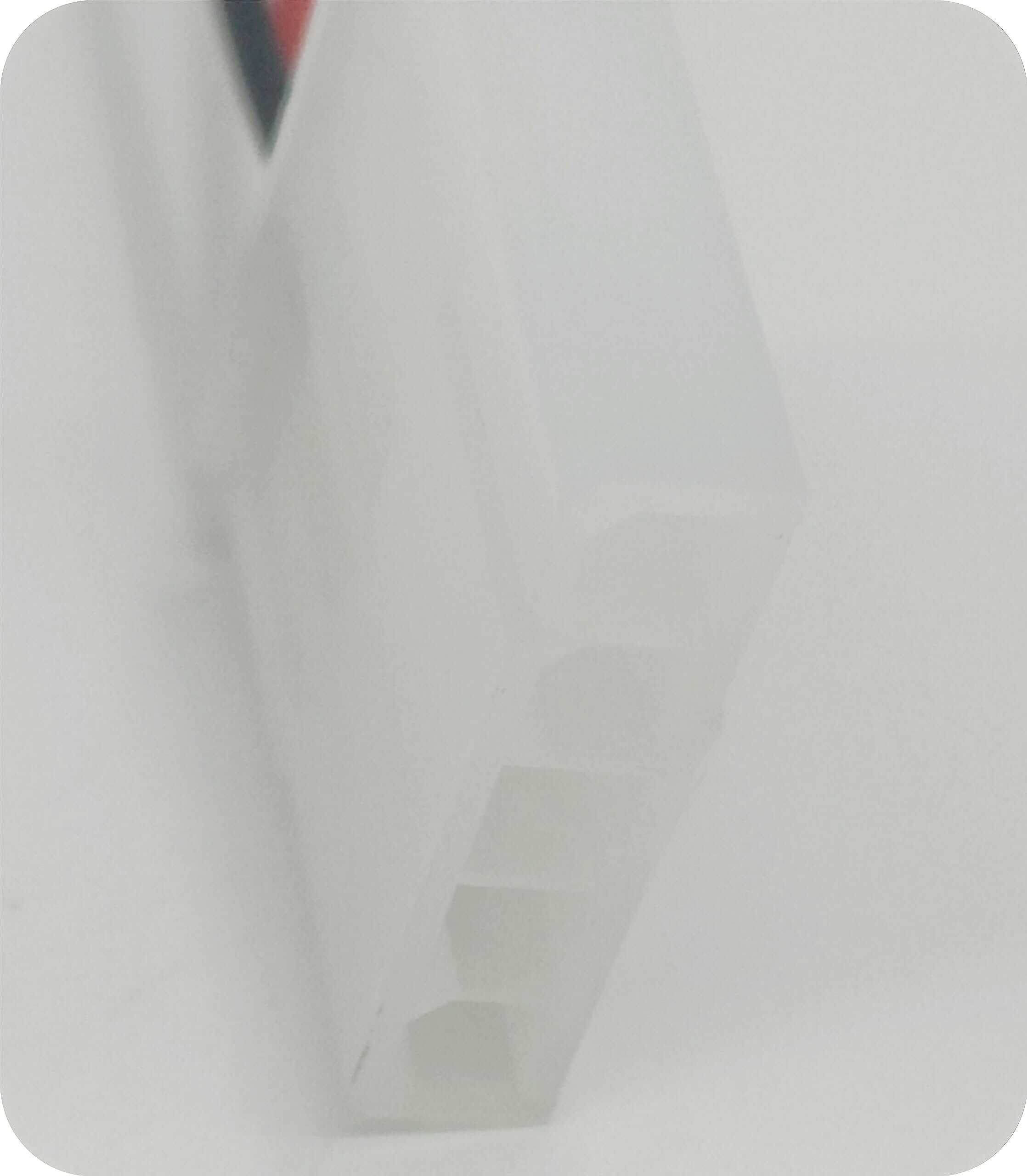 Placa de Luz LED para Refrigerador Delixike para Whirlpool - Imagen 8