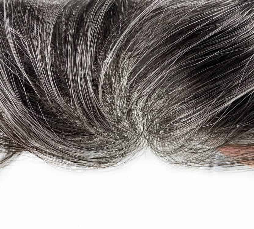 Tupé de línea frontal para hombres con pérdida de cabello - Imagen 8