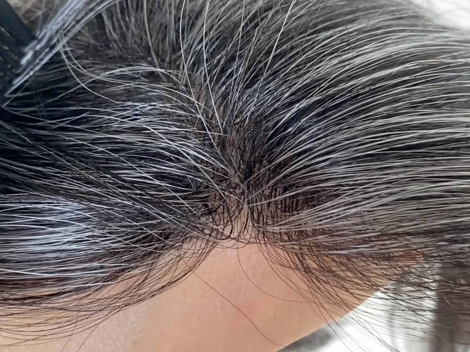 Tupé de línea frontal para hombres con pérdida de cabello - Imagen 6