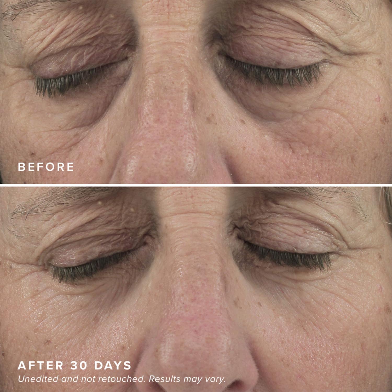 DRMTLGY Brightening Eye Masks (30 Pares) - Máscaras de - Imagen 6