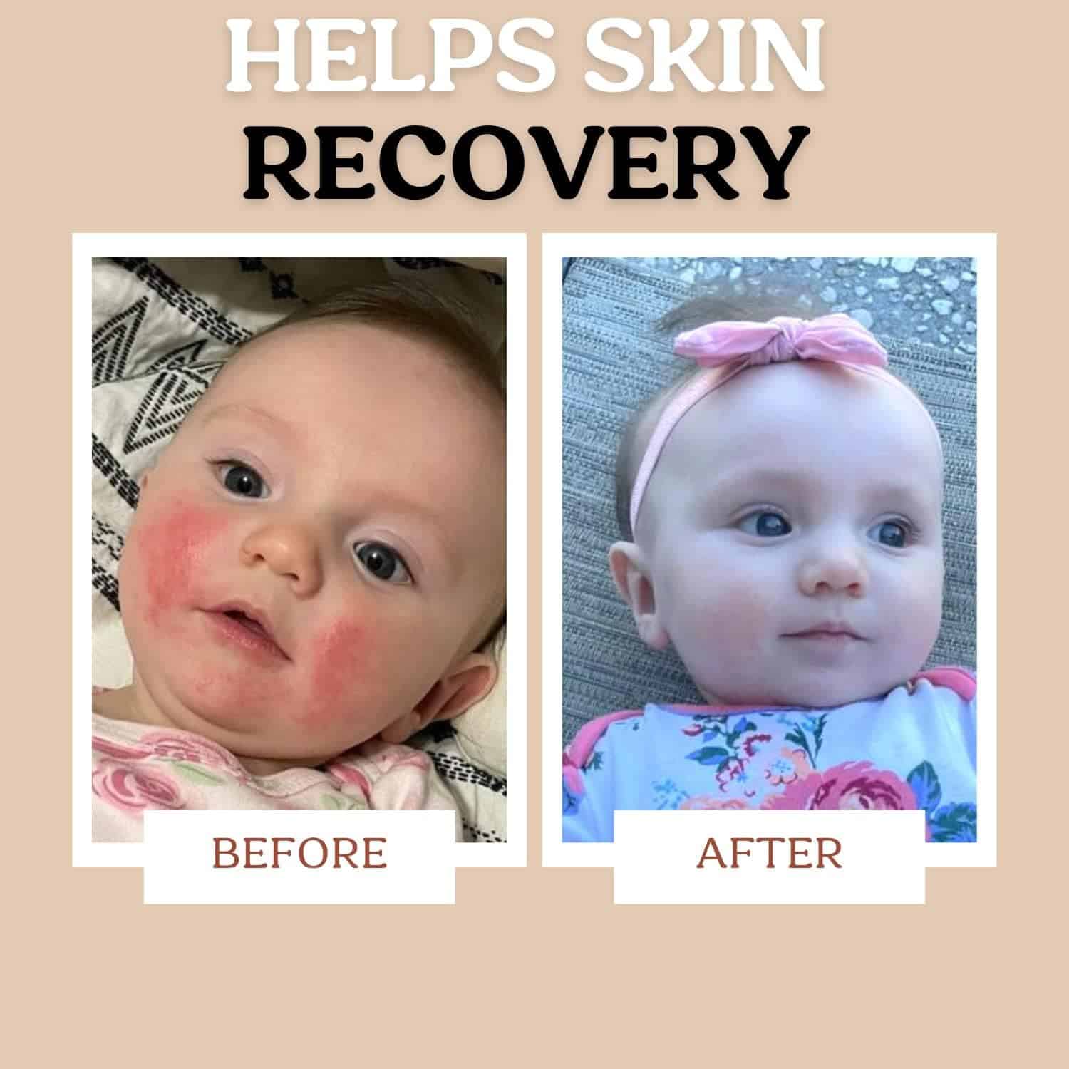 Duo de Crema y Suero para Bebés Roe Wellness Biome Barrier - Imagen 5