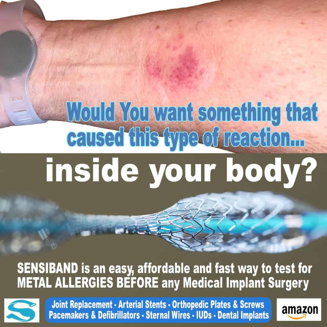 Sensiband Prueba de Alergia a los Metales para Piercings, - Imagen 6