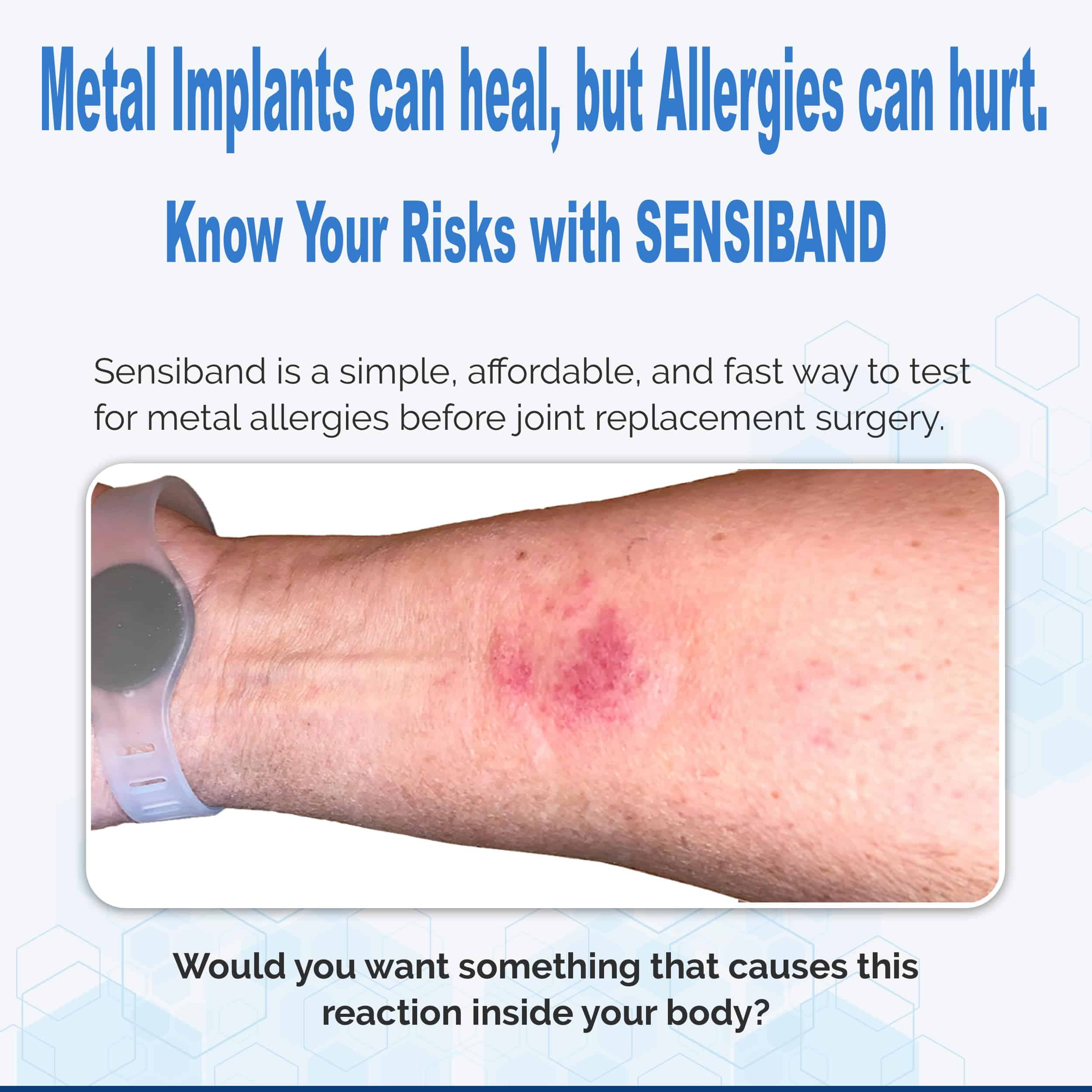 Sensiband Prueba de Alergia a los Metales para Piercings, - Imagen 5