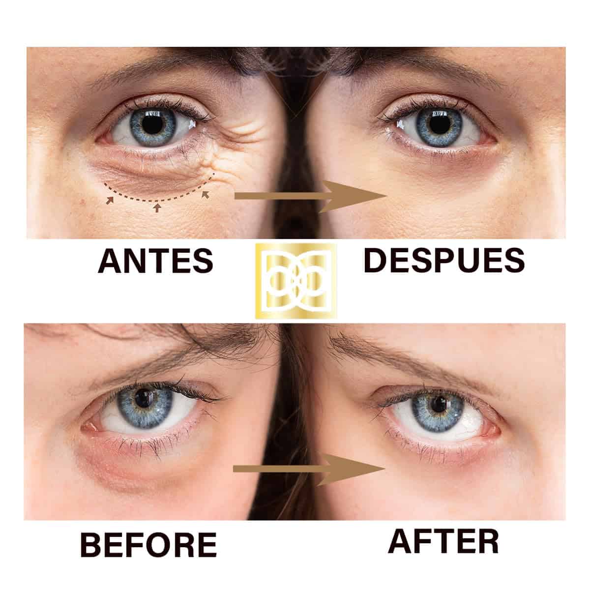 Set de Cuidado de Ojos DIANA DIORO 24K ULTIMATE - Lujosas - Imagen 3