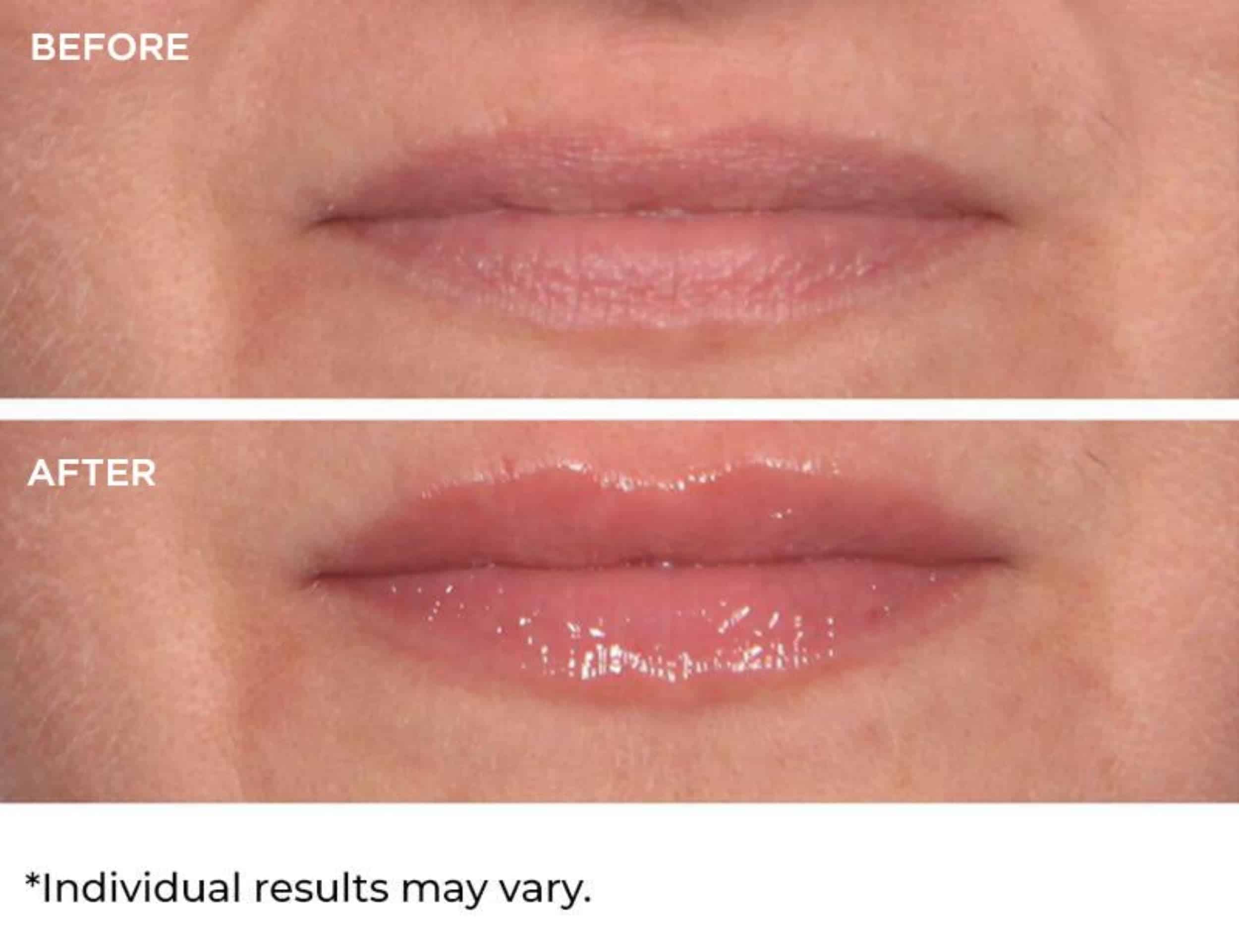 NassifMD Hydro-Screen para Labios - Pink Champagne - Imagen 4