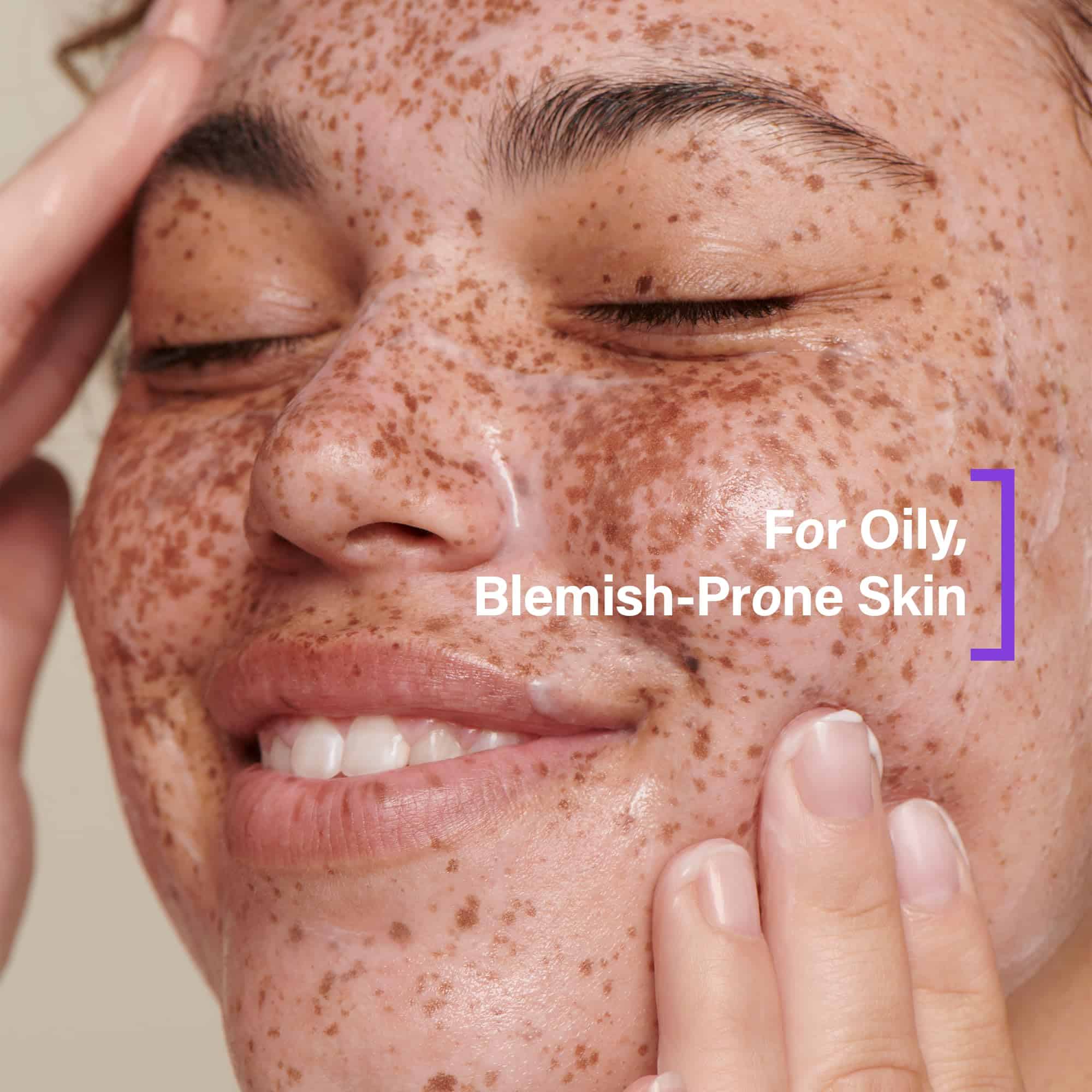 Coats Blemish Defense 3-Step Bundle - Limpiador de Arcilla, - Imagen 5