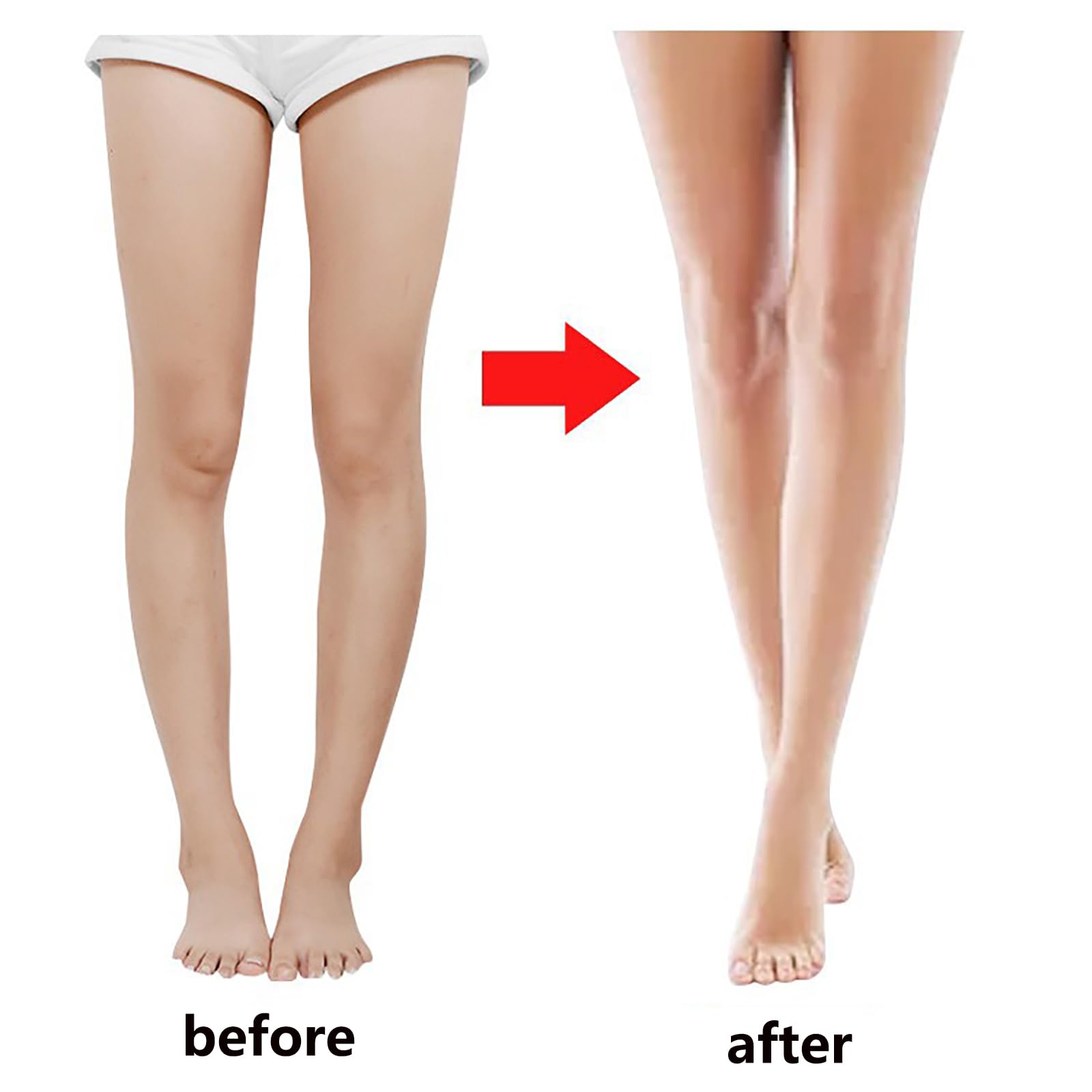 Cinturón de corrección de piernas GGFSSQ - 3 en 1 O/X - Imagen 4