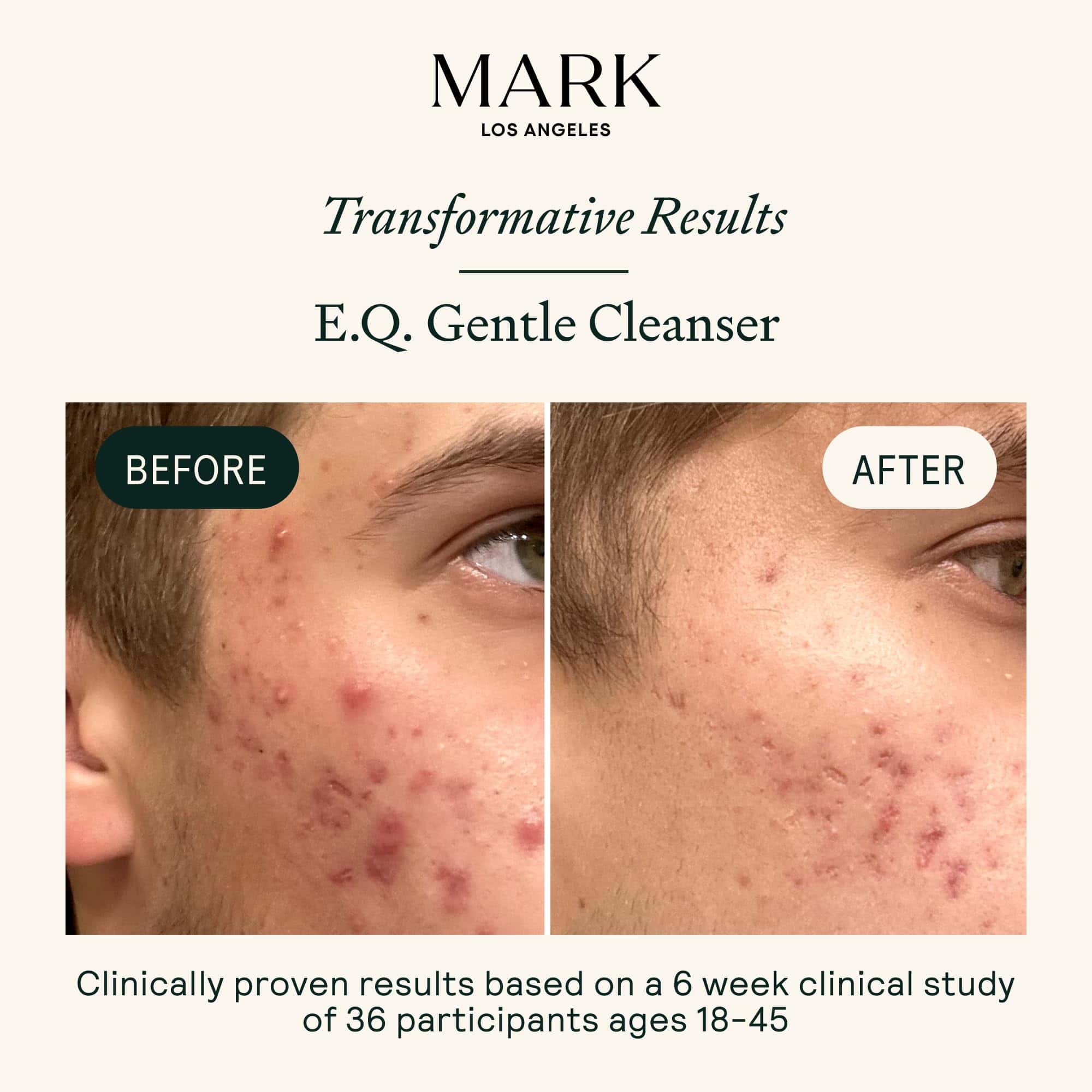 Limpiador Suave para Pieles Saludables MARK Los Angeles EQ - Imagen 4