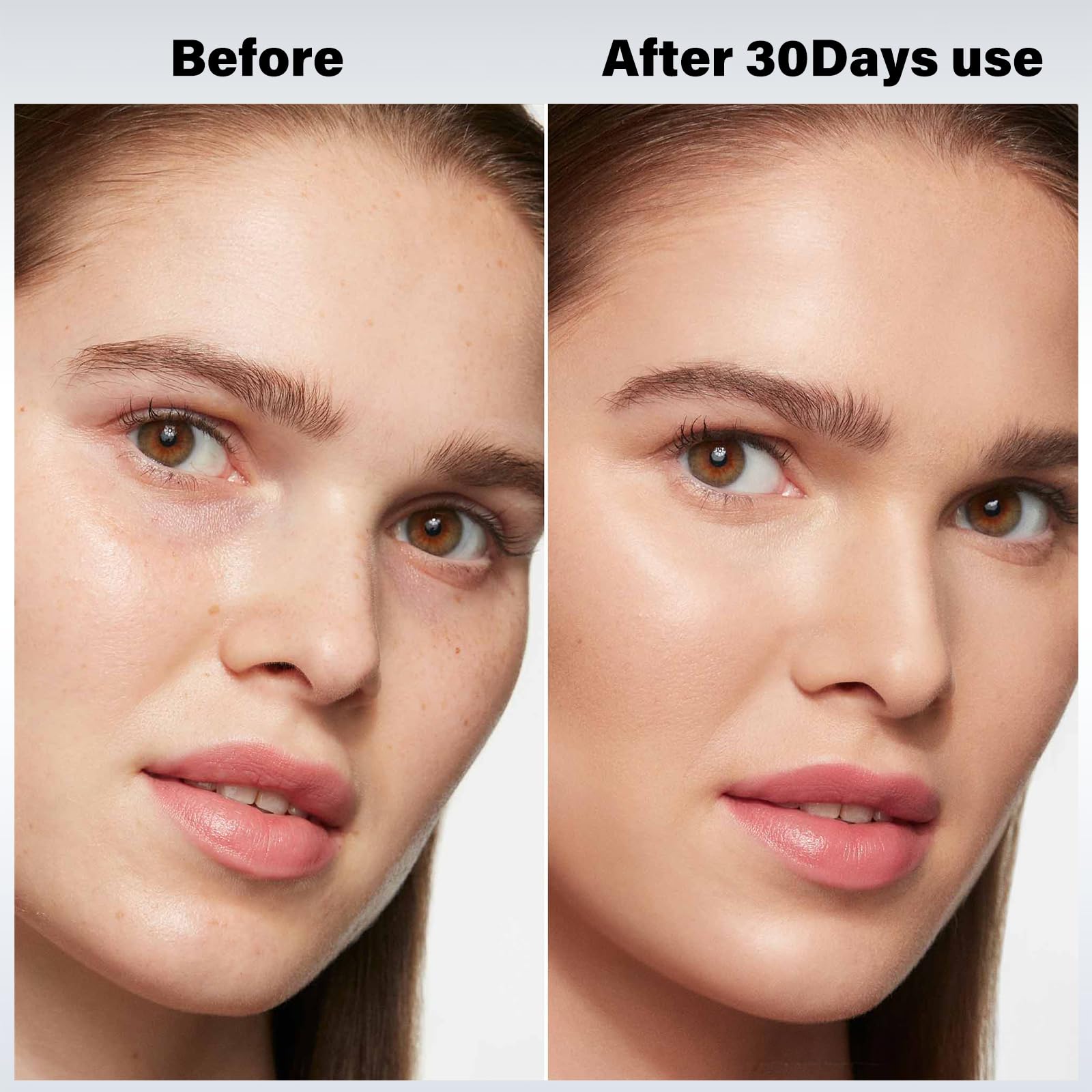 Dispositivo Facial Refirmante Vcycal Cool and Hot, - Imagen 4