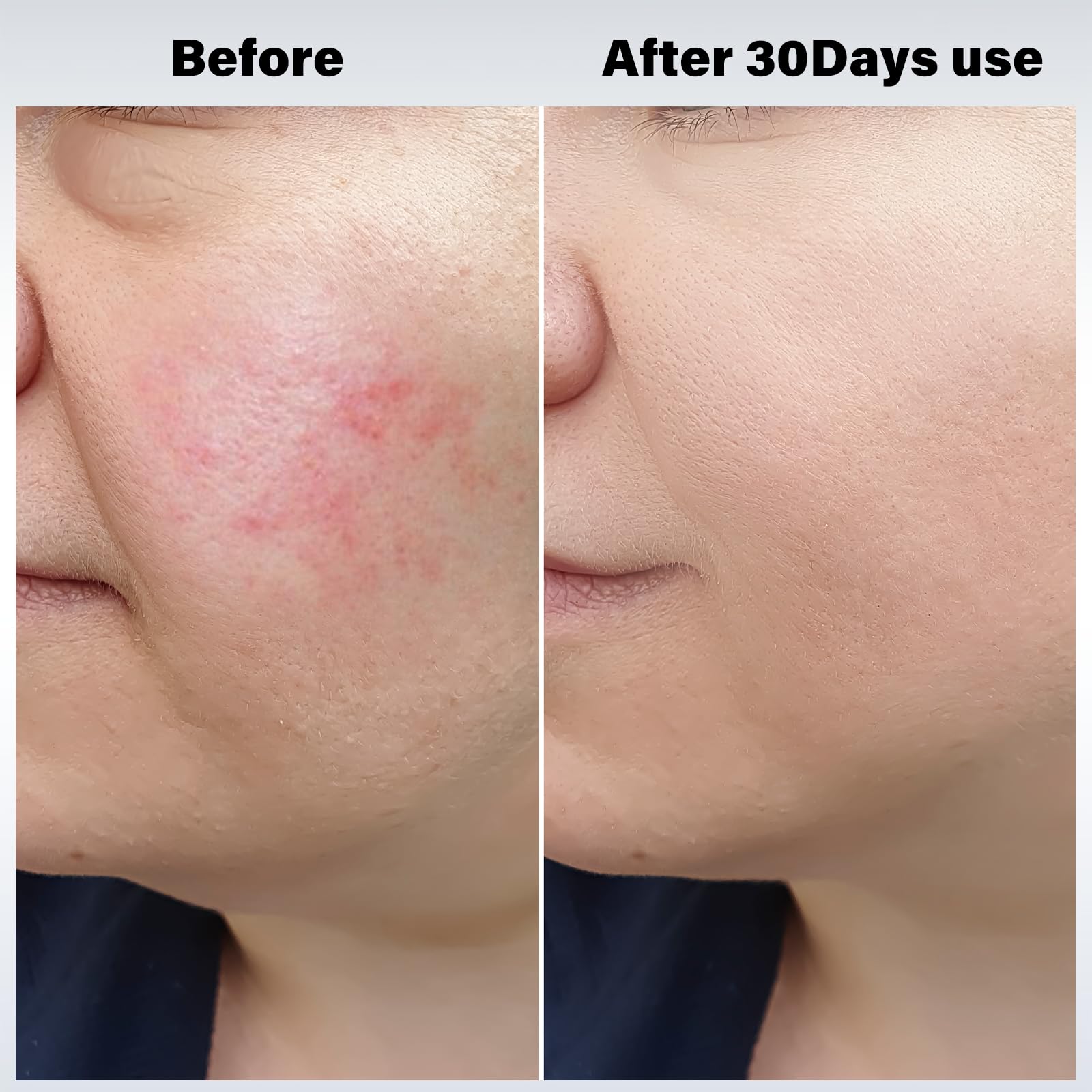 Dispositivo Facial Refirmante Vcycal Cool and Hot, - Imagen 5