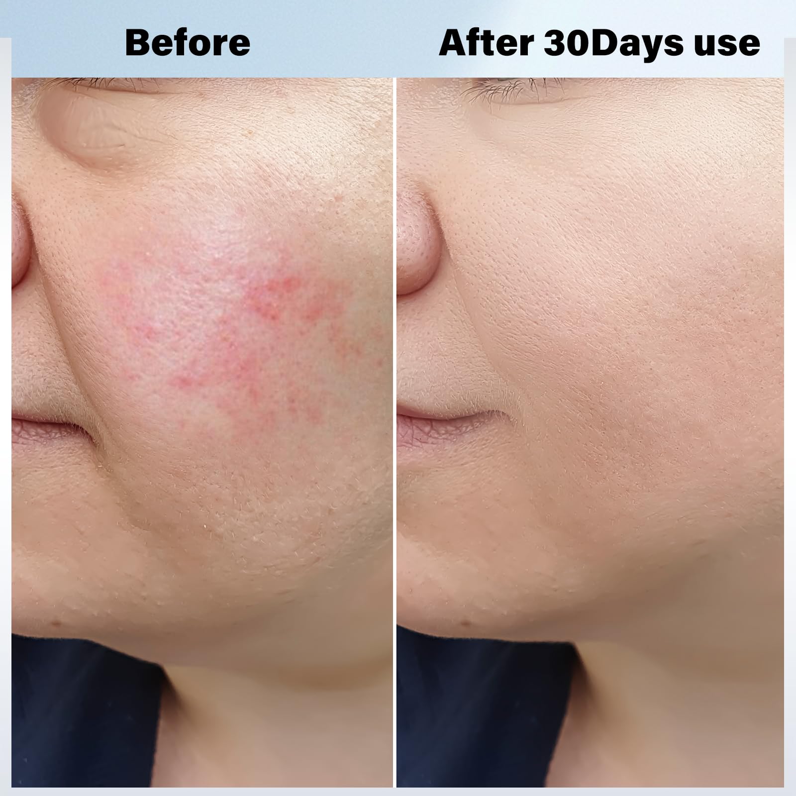 Dispositivo de Firmeza con Calentamiento y Enfriamiento - Imagen 4