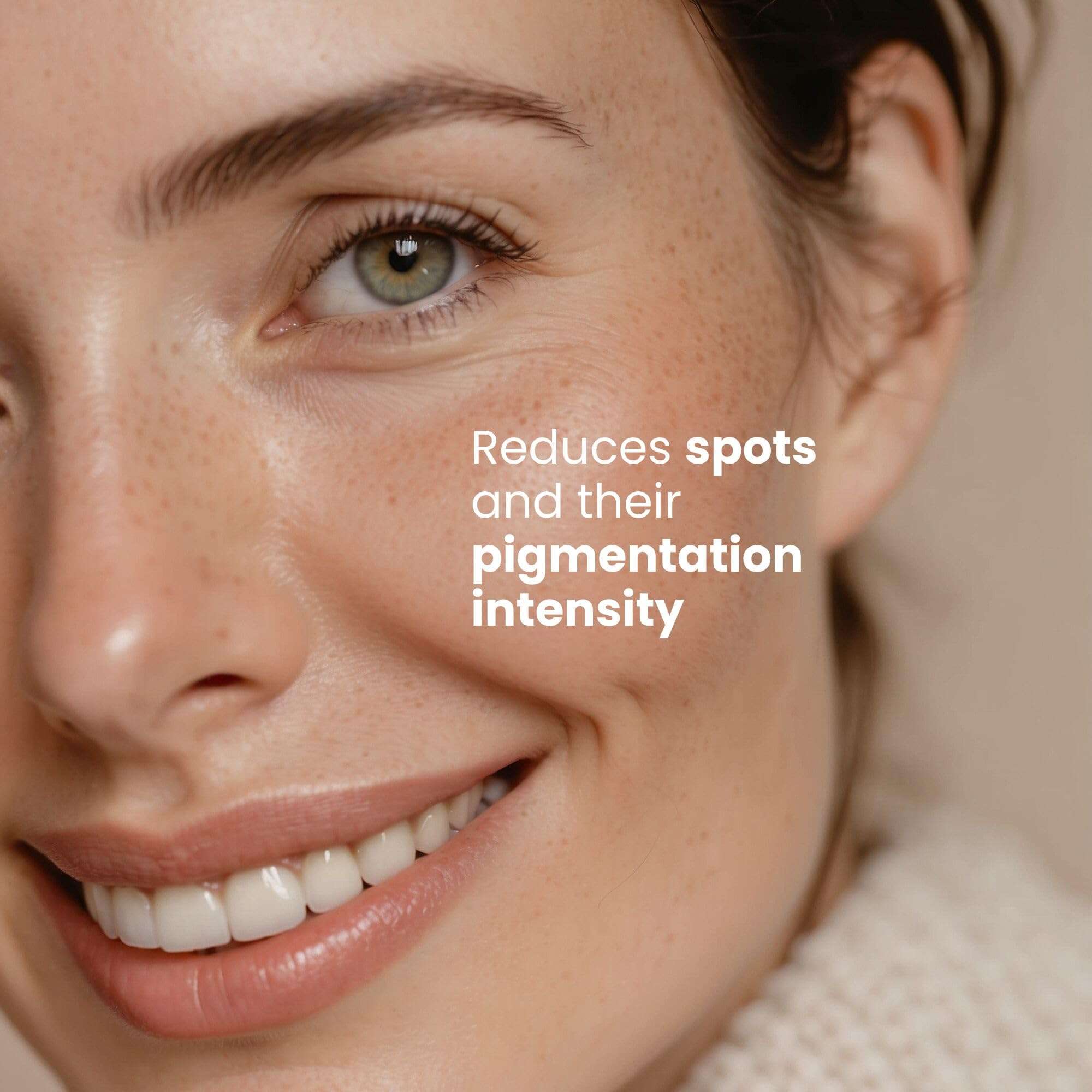 Serum Anti Manchas con Niacinamida - Reduce Pigmentación y - Imagen 4