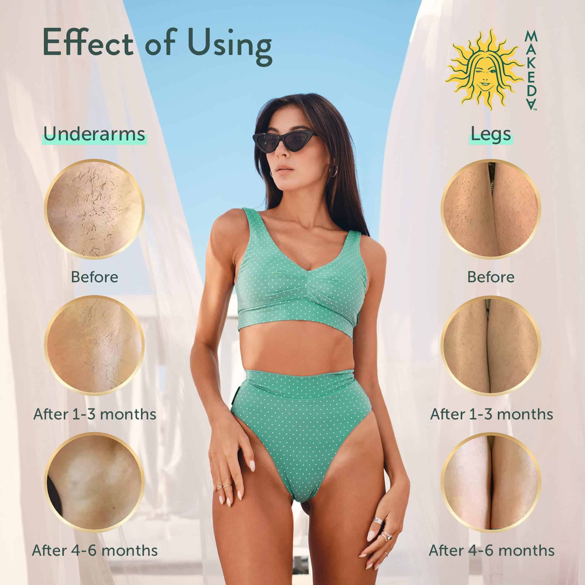 Tratamiento para el vello encarnado Makeda Lotion - Cuidado - Imagen 9