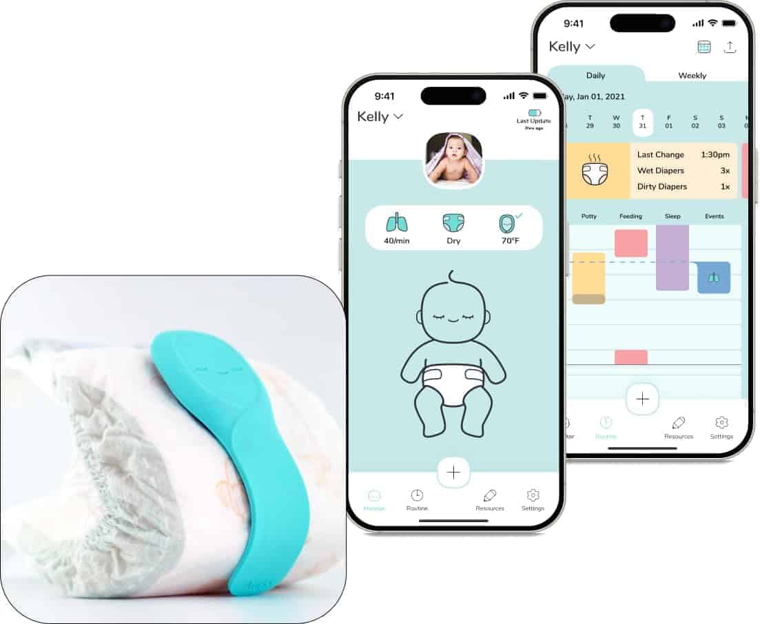 Monitor inteligente para bebés Aurio, realiza seguimiento