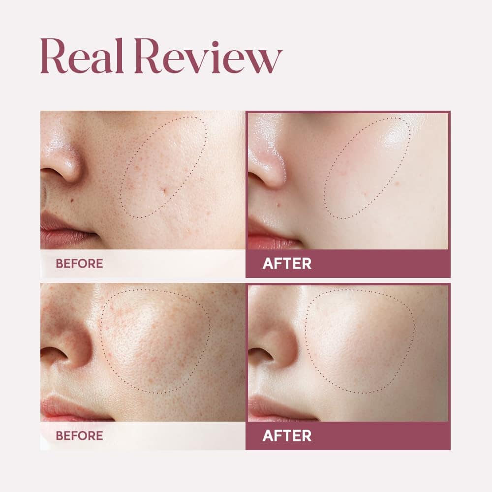 Suero Transformador para la Piel Lulubeu con Tecnología de - Imagen 3