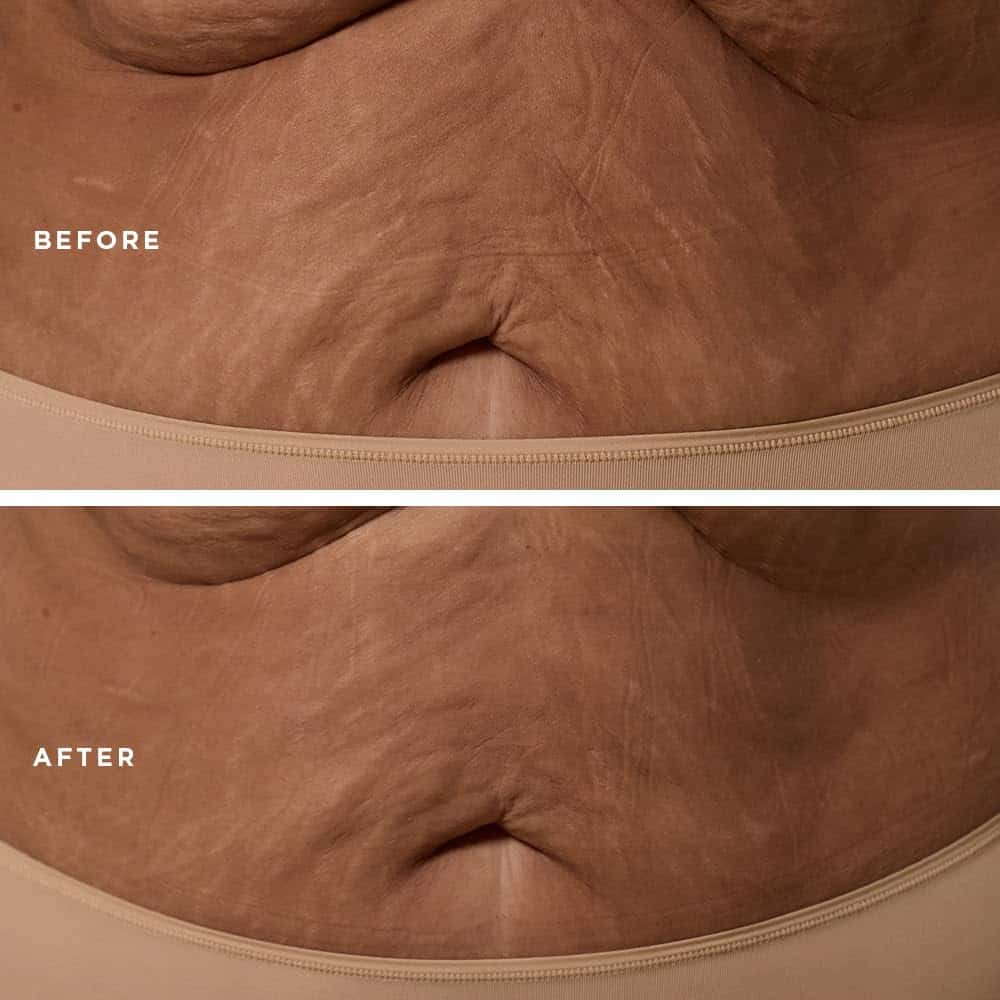 Crema Corporal Esculpidora, Reafirmante y Acondicionadora - Imagen 7