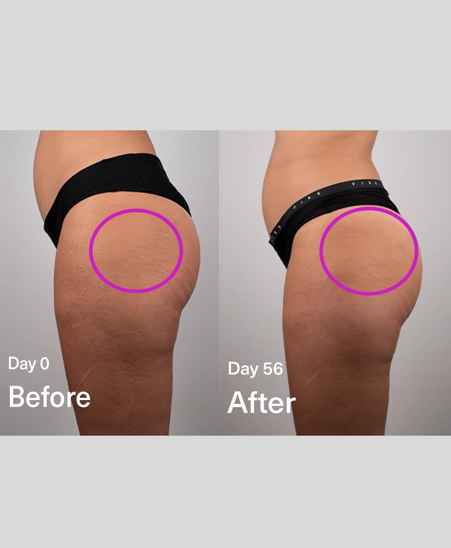 DropOff Gel-Serum, Crema Reafirmante Corporal, Reductor de - Imagen 3