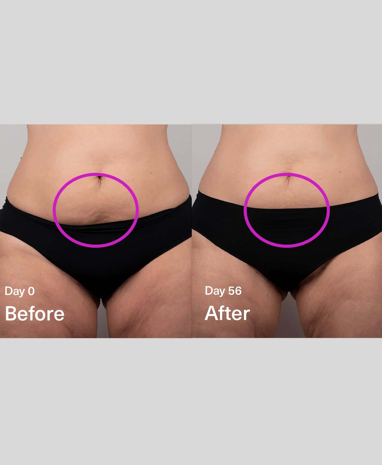 DropOff Gel-Serum, Crema Reafirmante Corporal, Reductor de - Imagen 7