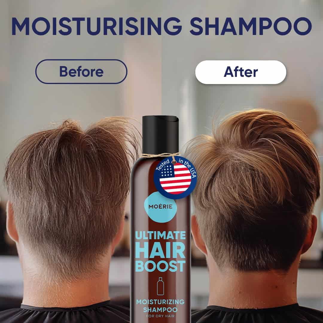 Shampoo de Crecimiento Capilar Moerie Ultimate - Para - Imagen 5
