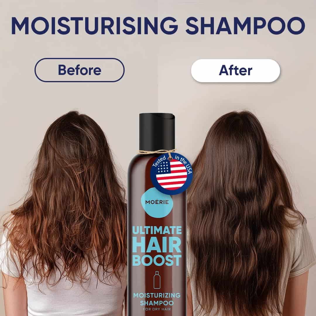 Shampoo de Crecimiento Capilar Moerie Ultimate - Para - Imagen 4