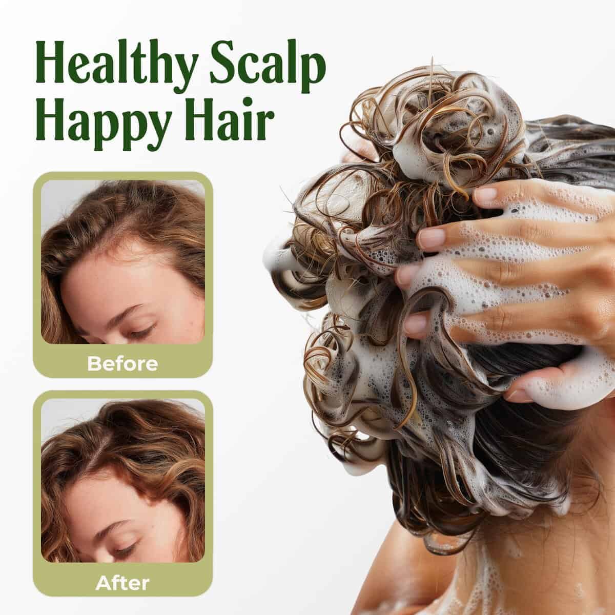 Shampoo de Romero Carolayage para el Crecimiento y - Imagen 8